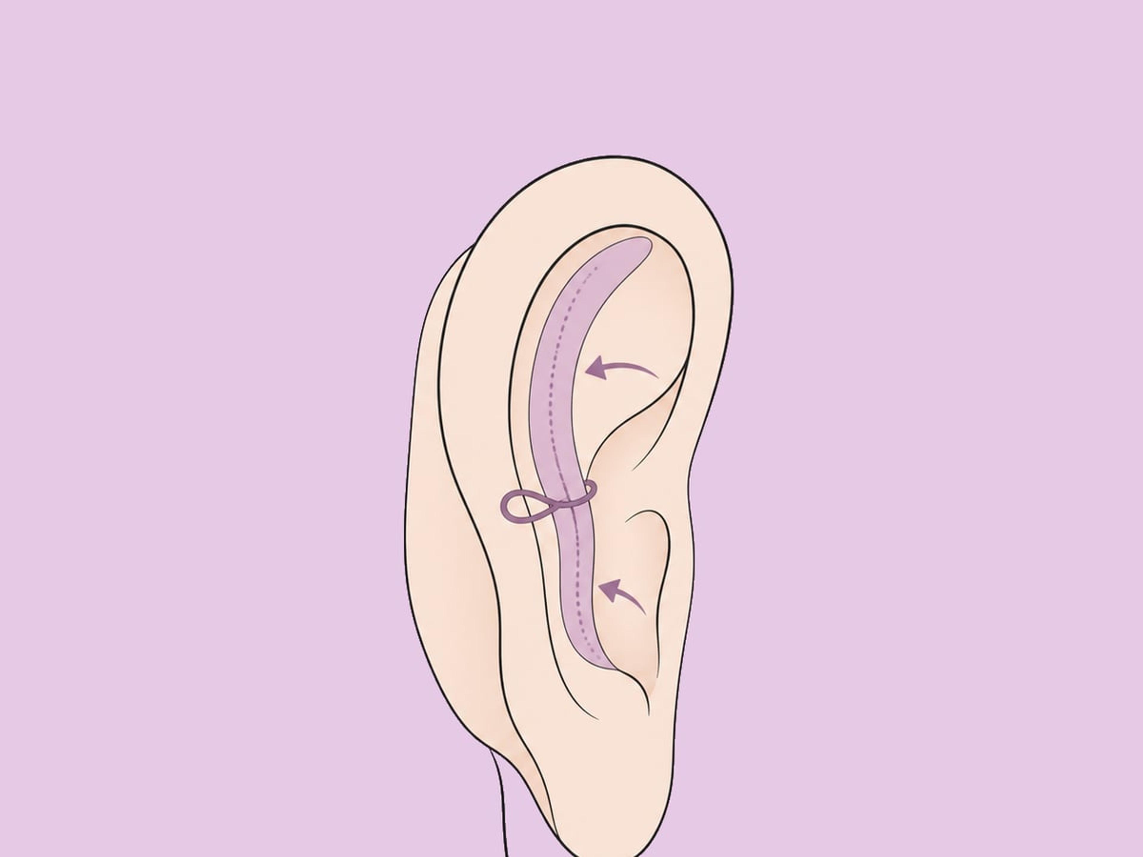 Kombinierter Ansatz — illustration