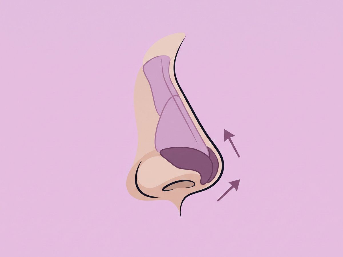 Stützung und Projektion der Nasenspitze — illustration
