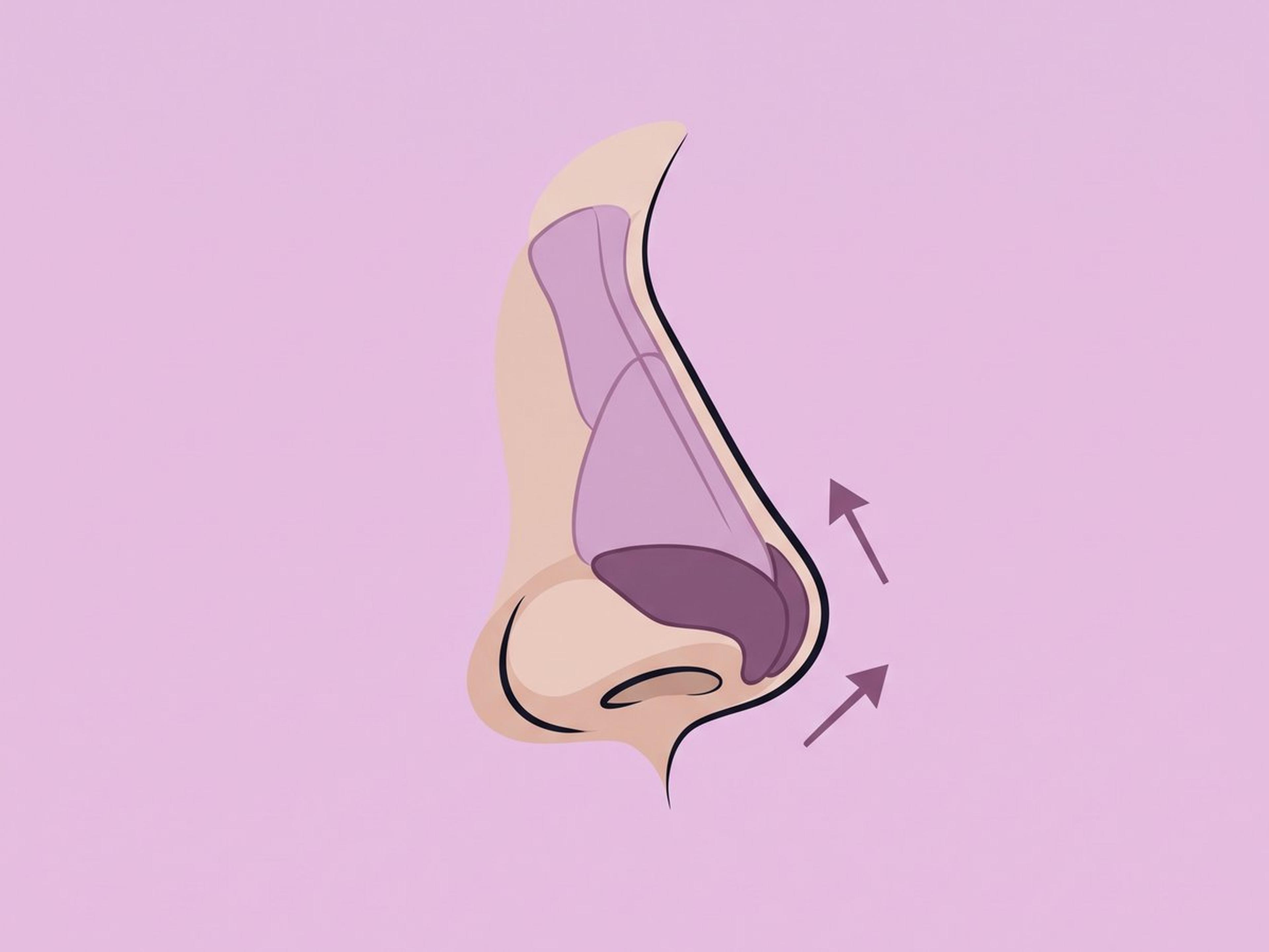 Stützung und Projektion der Nasenspitze — illustration