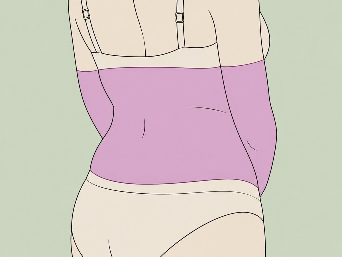 360-Fettabsaugung (Lipo 360) — illustration