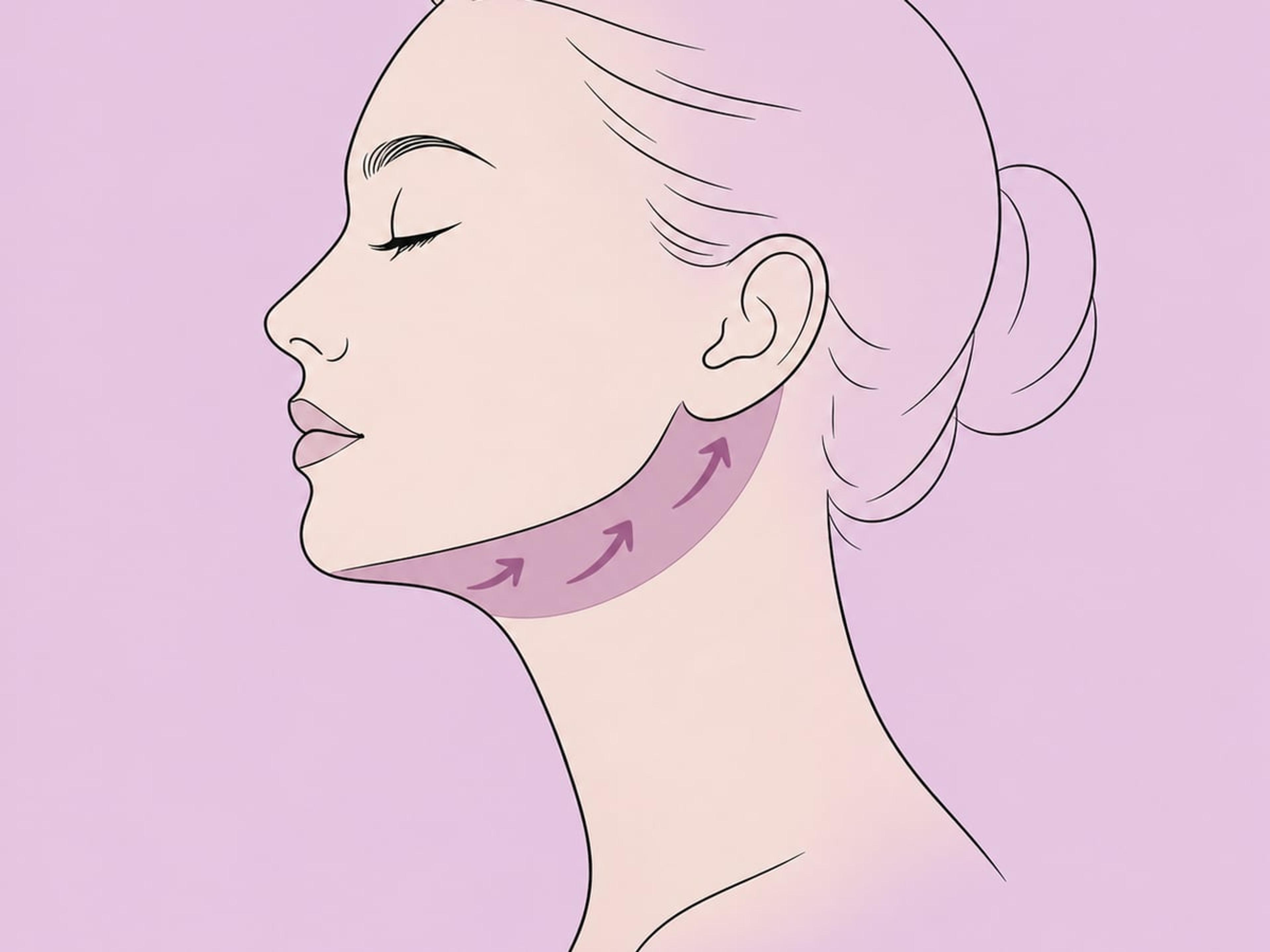 Deep-Plane-Halsstraffung — illustration