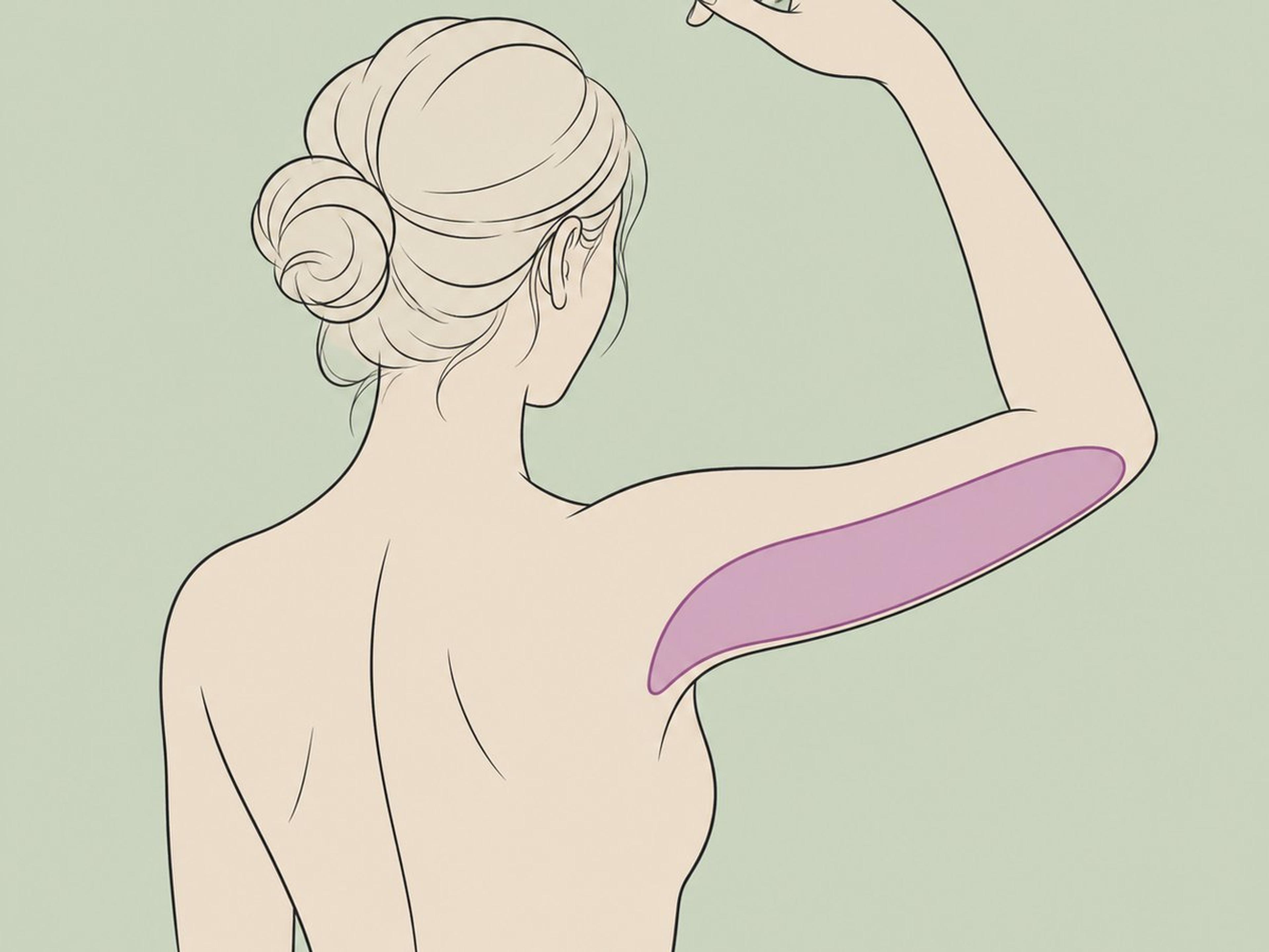 Fettabsaugung an den Armen — illustration