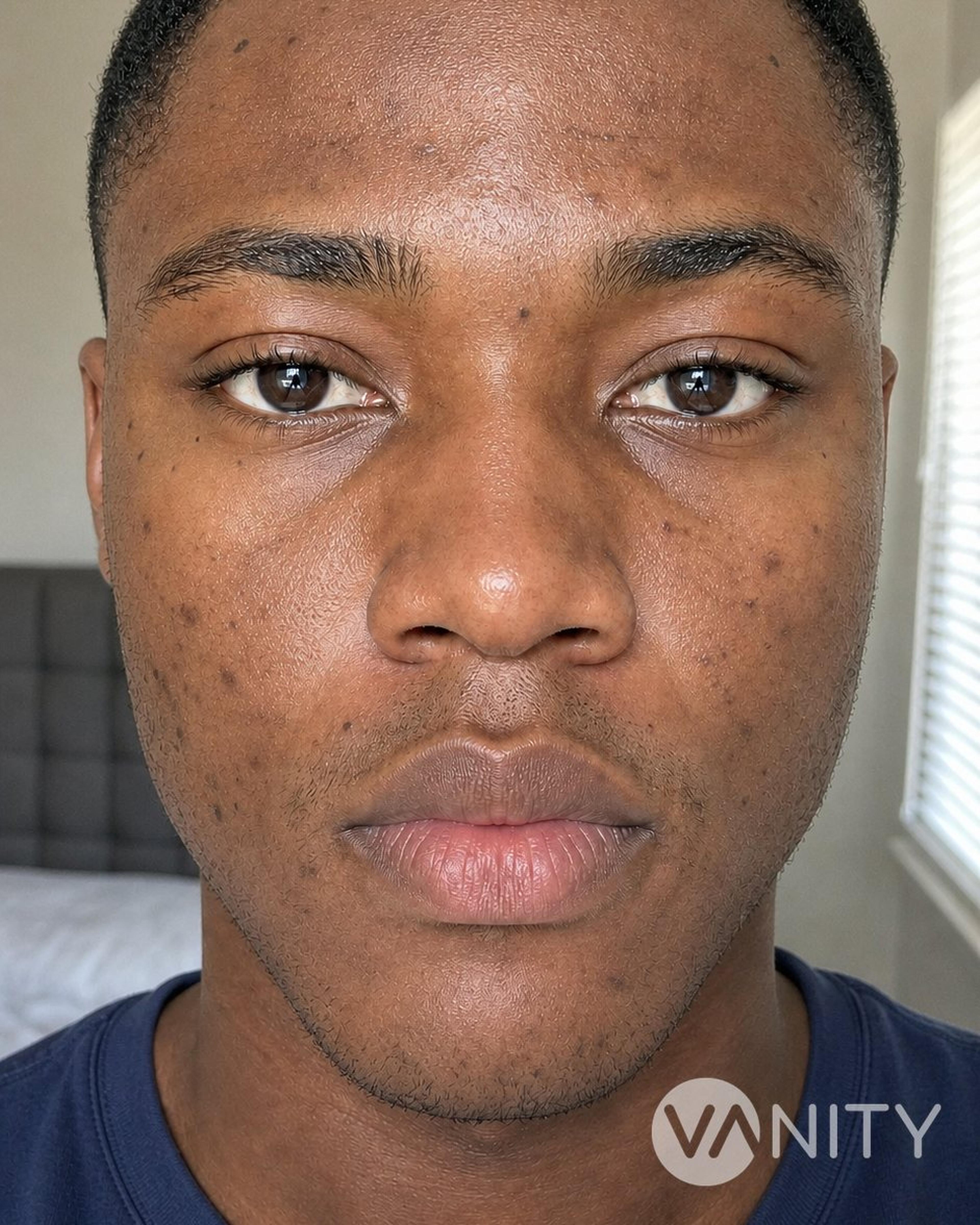 After Ozone therapy — illustrative, not a real patient