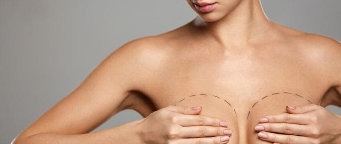 10 mythes sur les implants mammaires