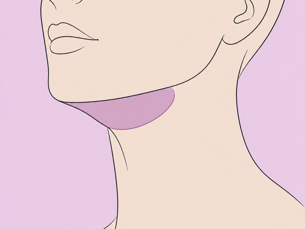 شفط الدهون تحت الذقن مع رأب الغمازات — illustration