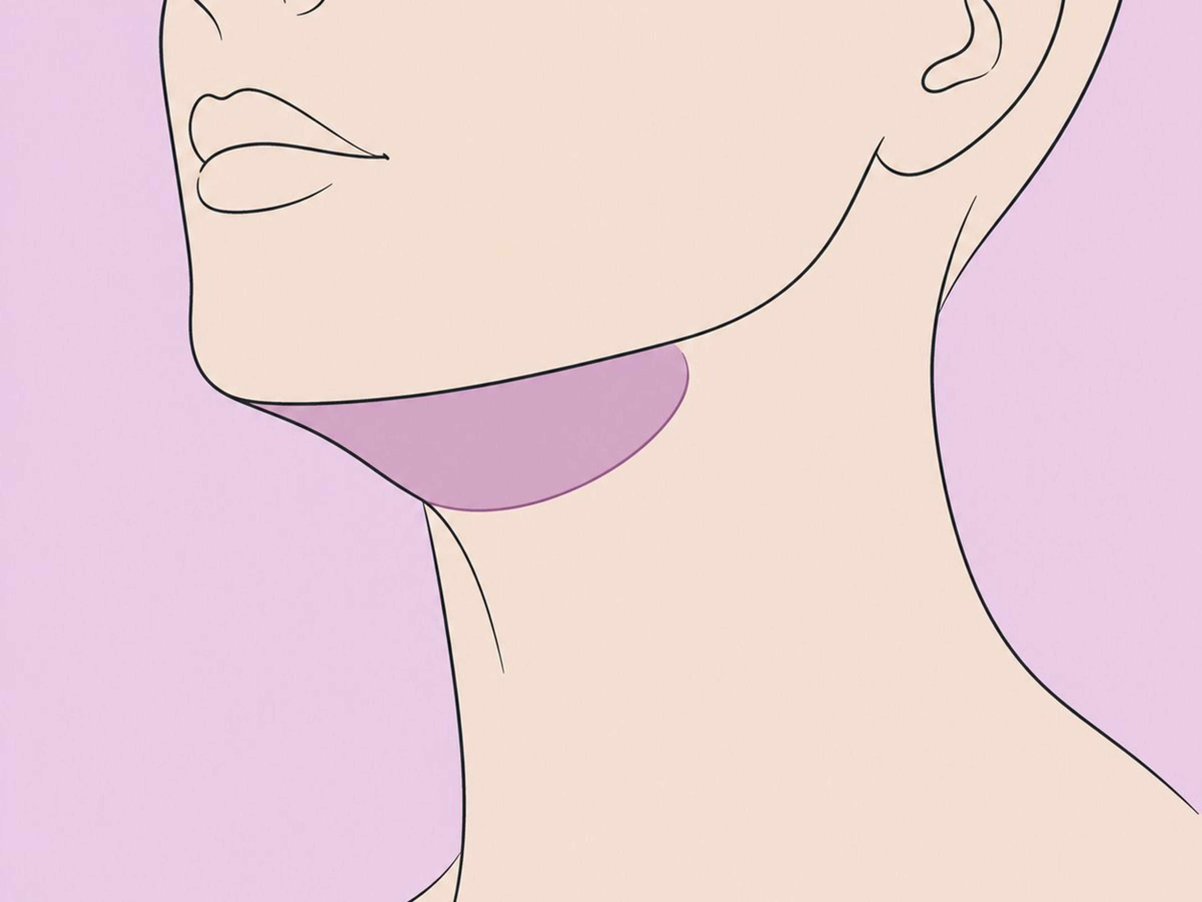 شفط الدهون تحت الذقن مع رأب الغمازات — illustration