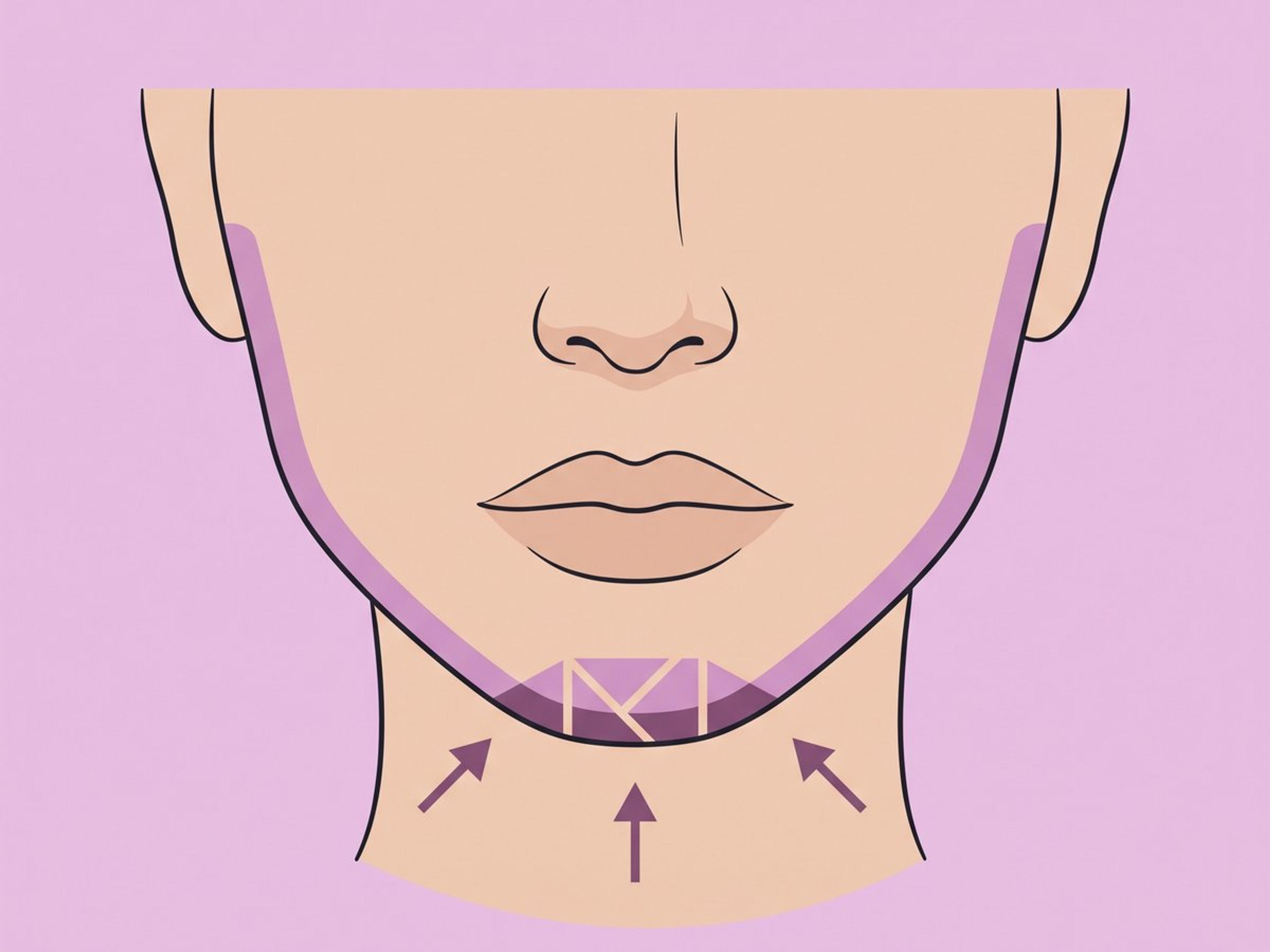 Jaw reshaping with complementary contouring — illustration