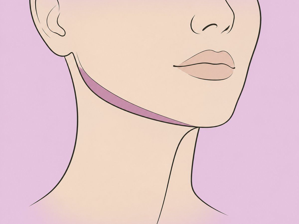 Inyección de grasa e implante de mandíbula — illustration