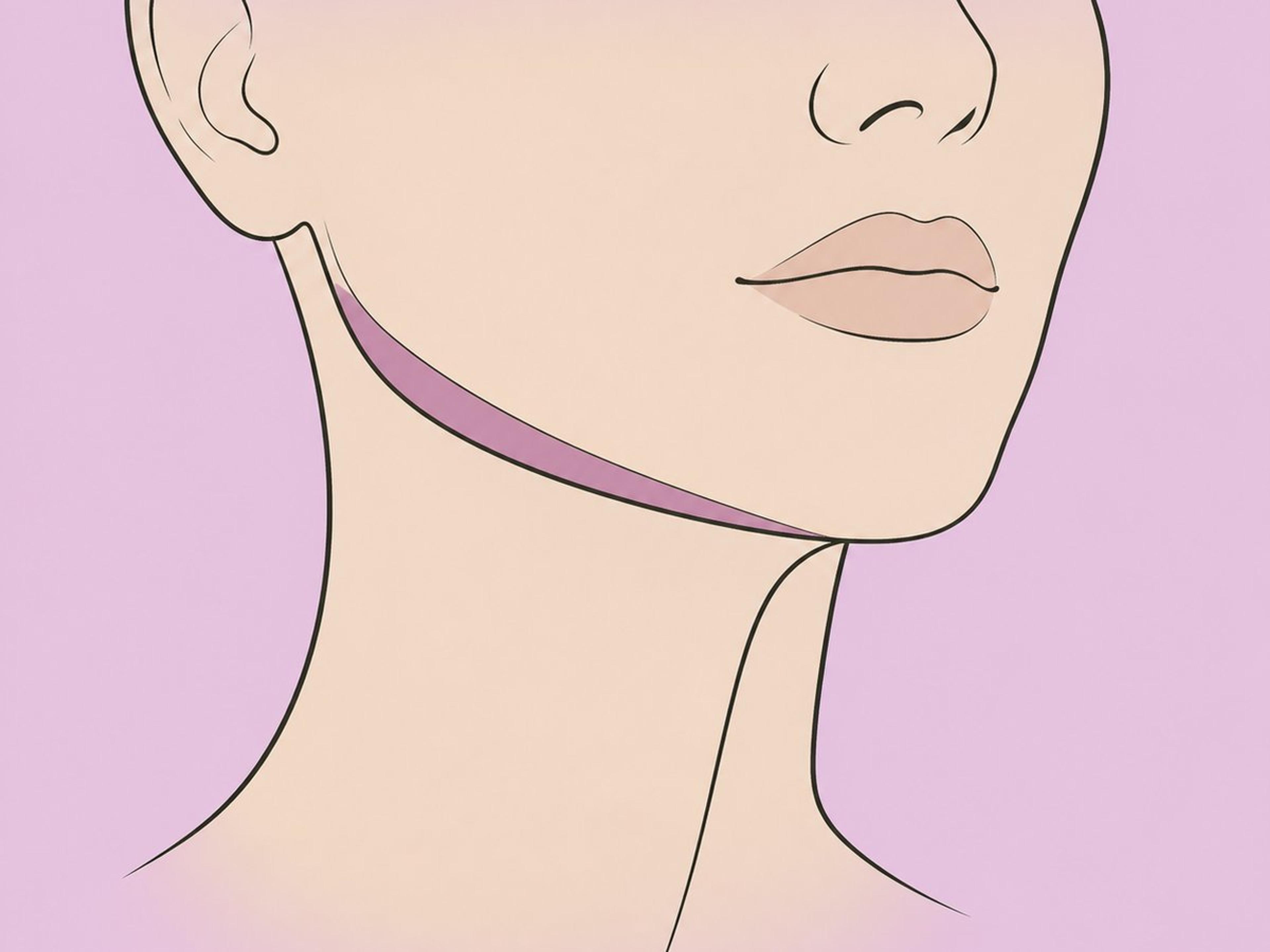 Inyección de grasa e implante de mandíbula — illustration