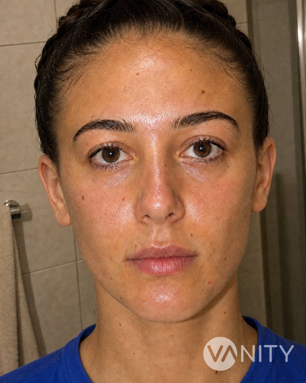 After Ear surgery — illustrative, not a real patient