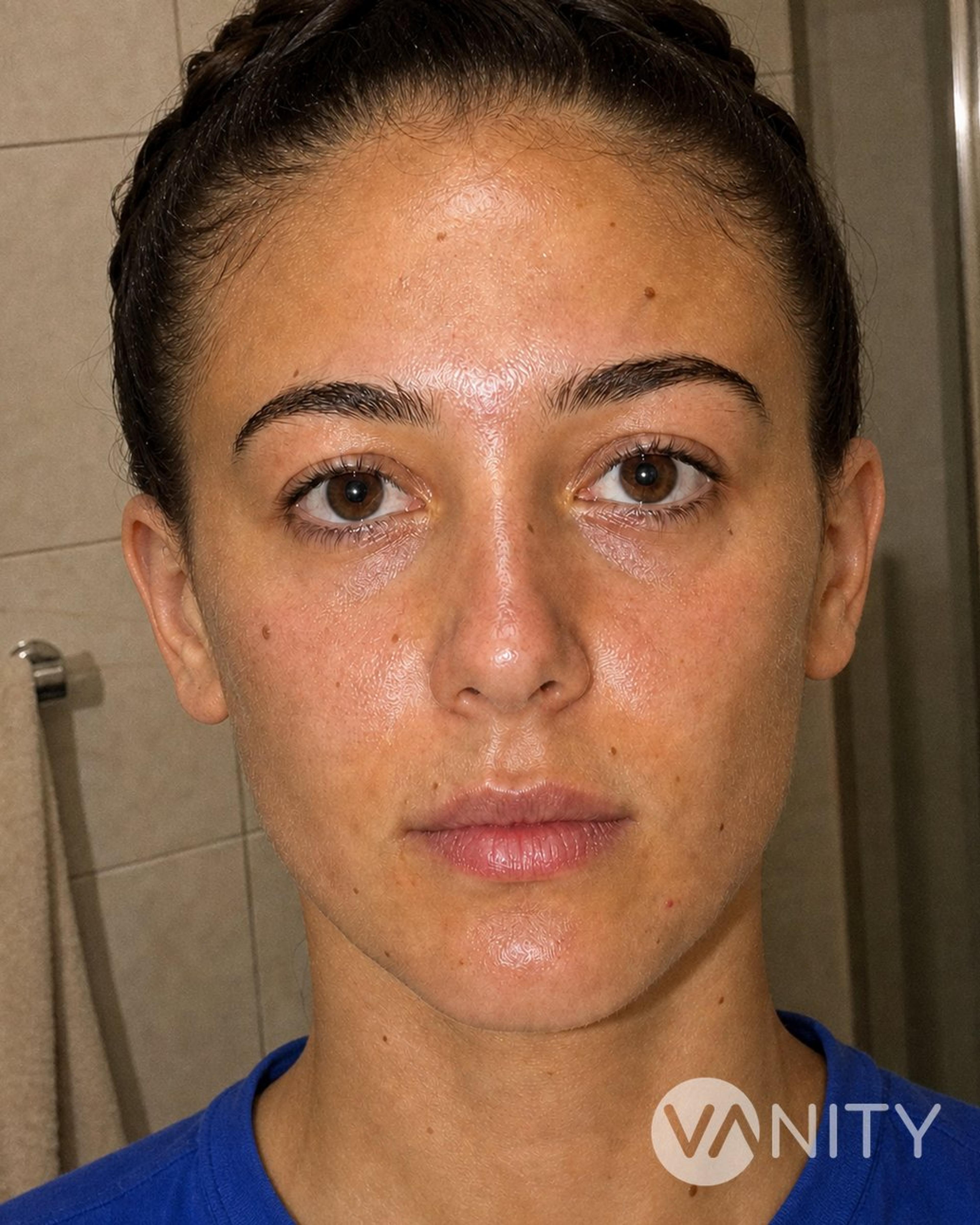 After Ear surgery — illustrative, not a real patient