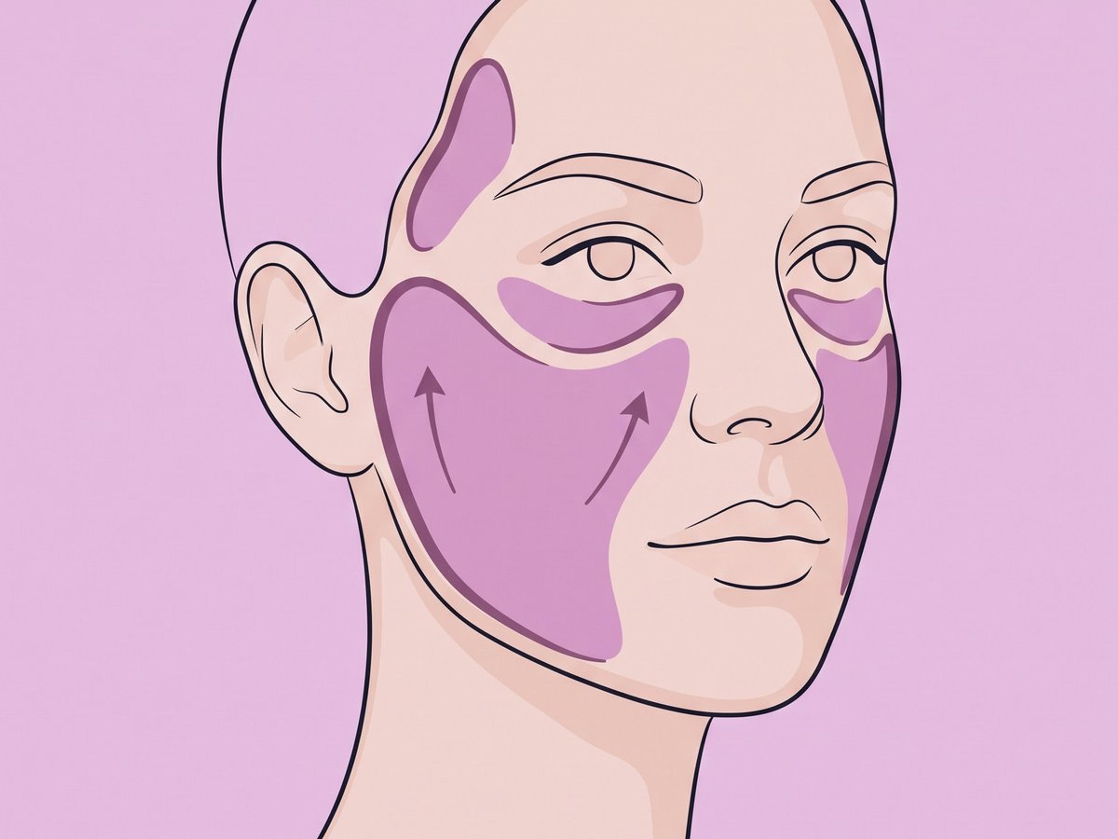 Facelift mit Eigenfetttransfer — illustration