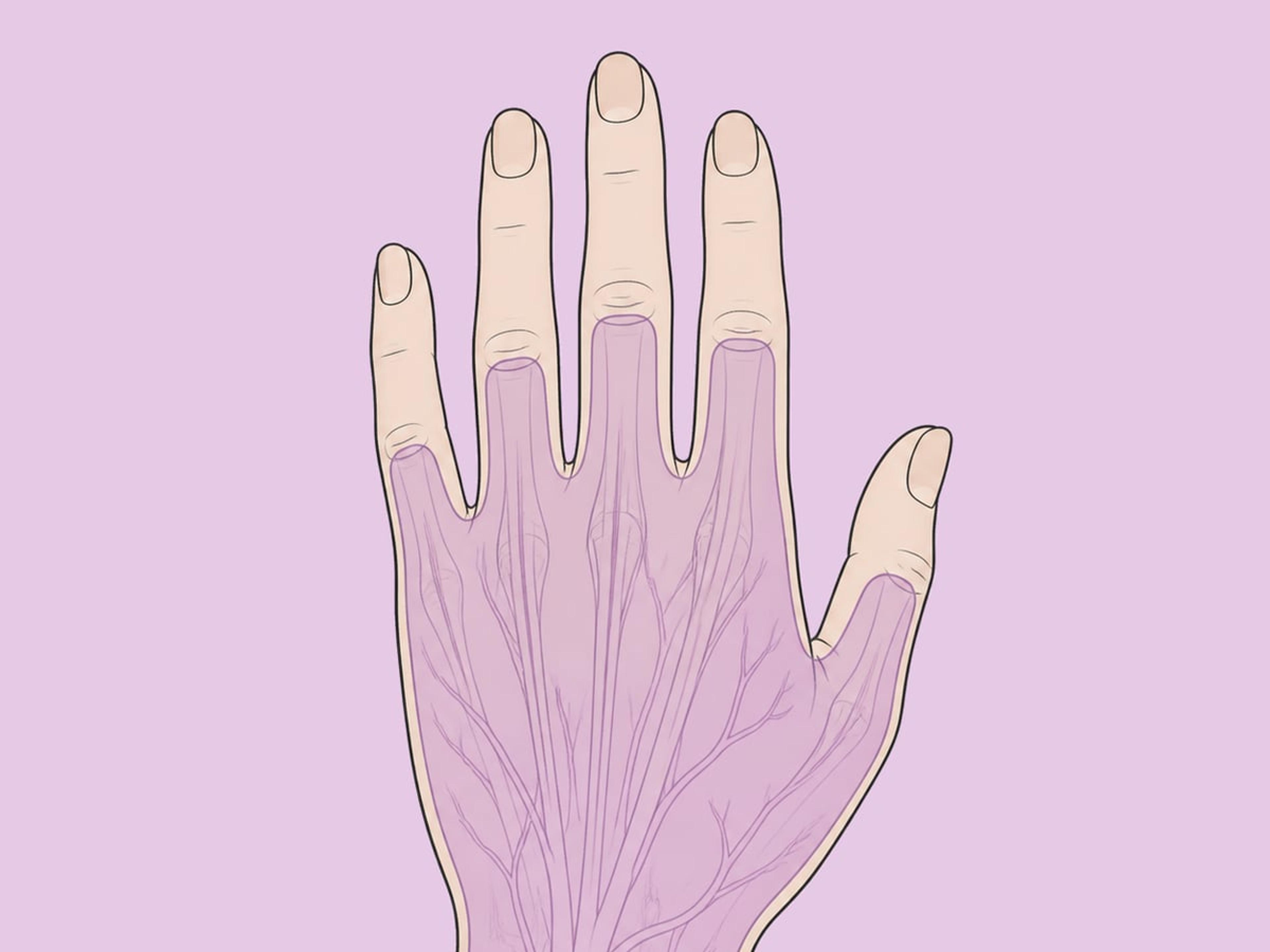 Handverjüngung mit Fetttransplantation — illustration