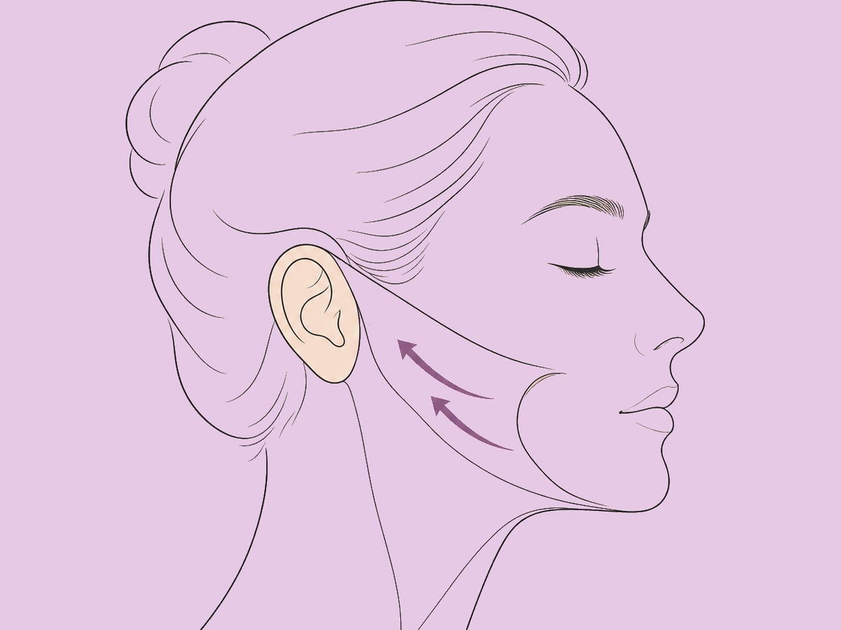 SMAS-Facelift — illustration