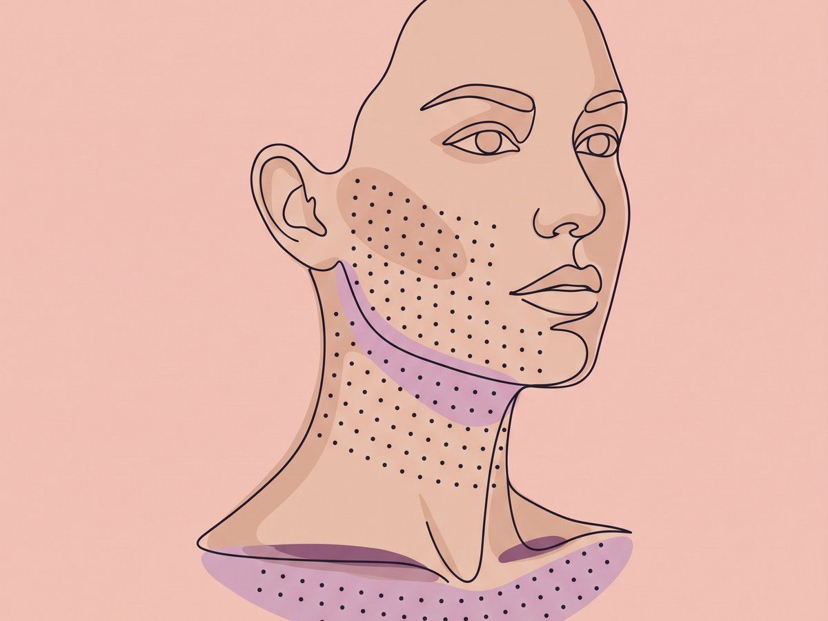 Booster-Kur mit stabilisierter nicht-tierischer HA (NASHA) — illustration