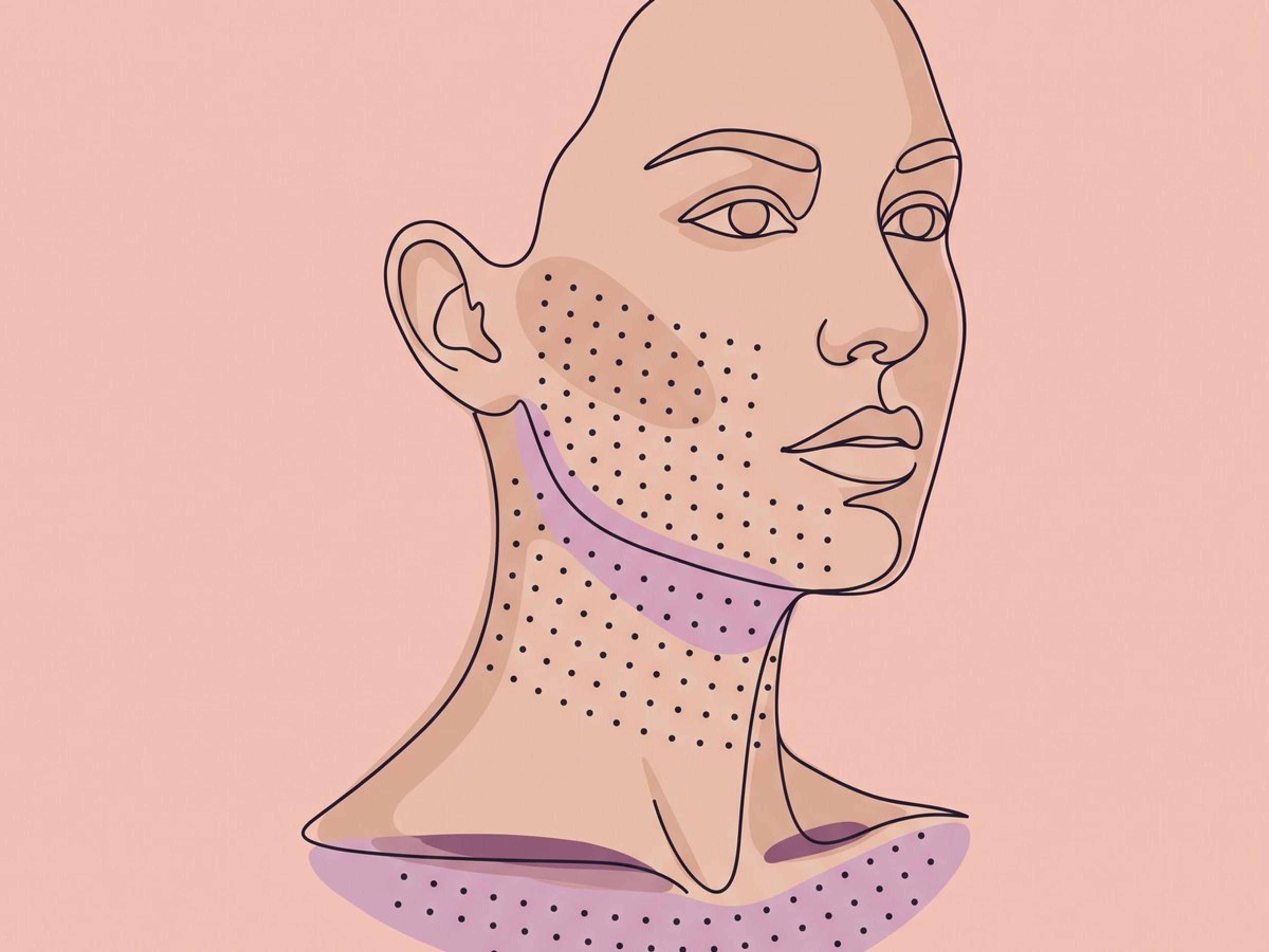 Booster-Kur mit stabilisierter nicht-tierischer HA (NASHA) — illustration