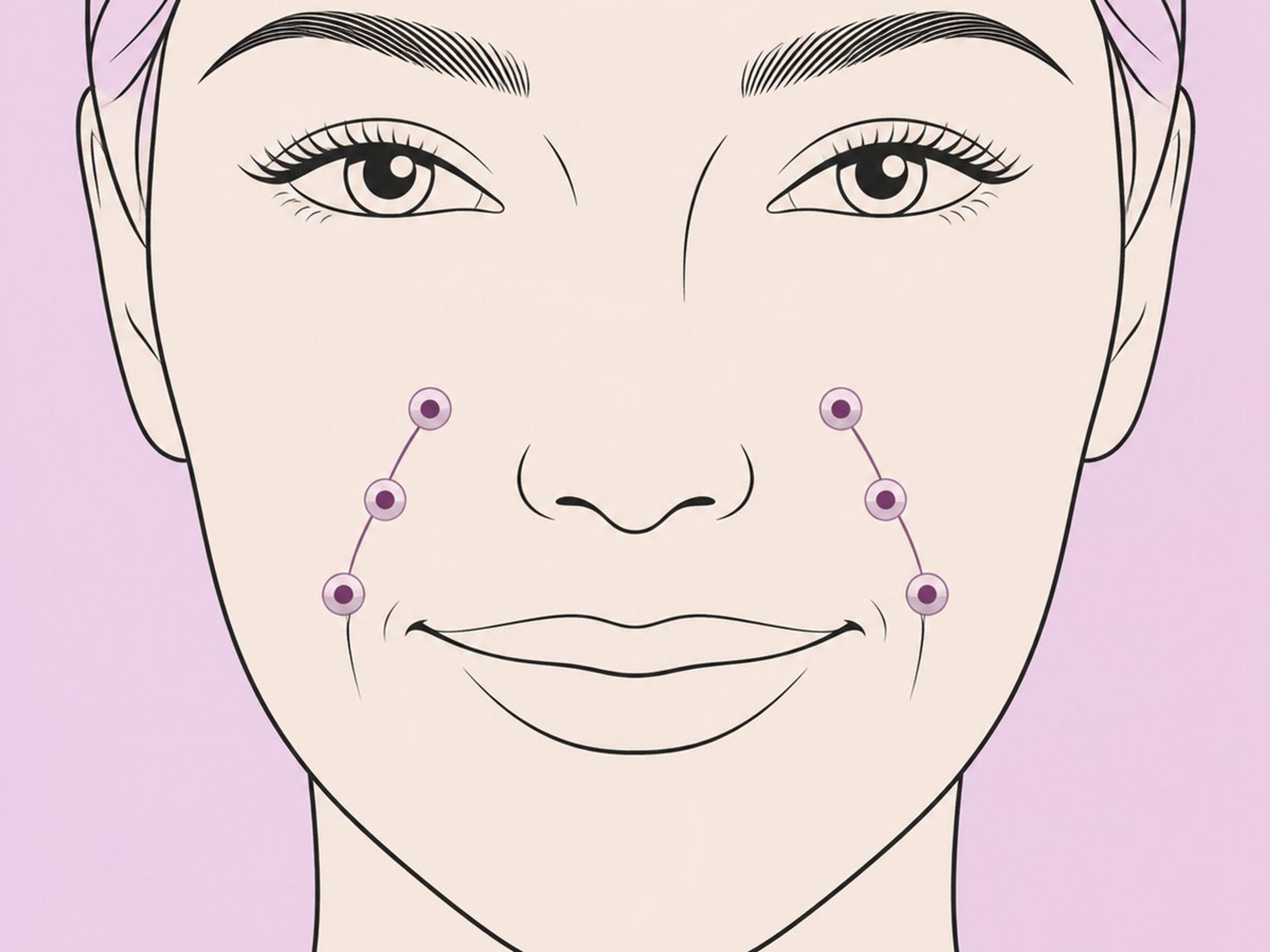الغمازات المزدوجة (ثنائية الجانب) — illustration