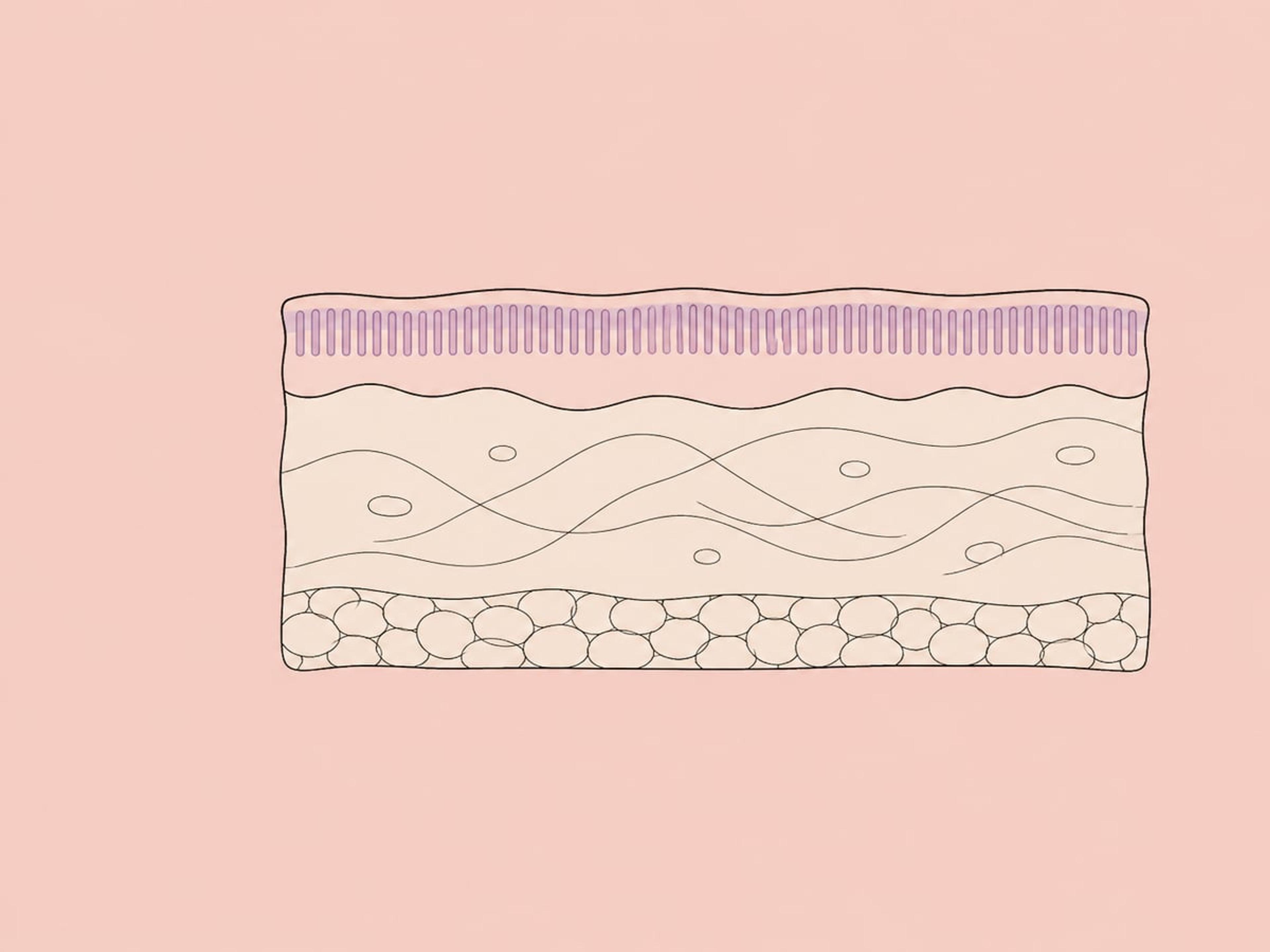 Fraktioniertes Thulium-Resurfacing mit 1.927 nm — illustration