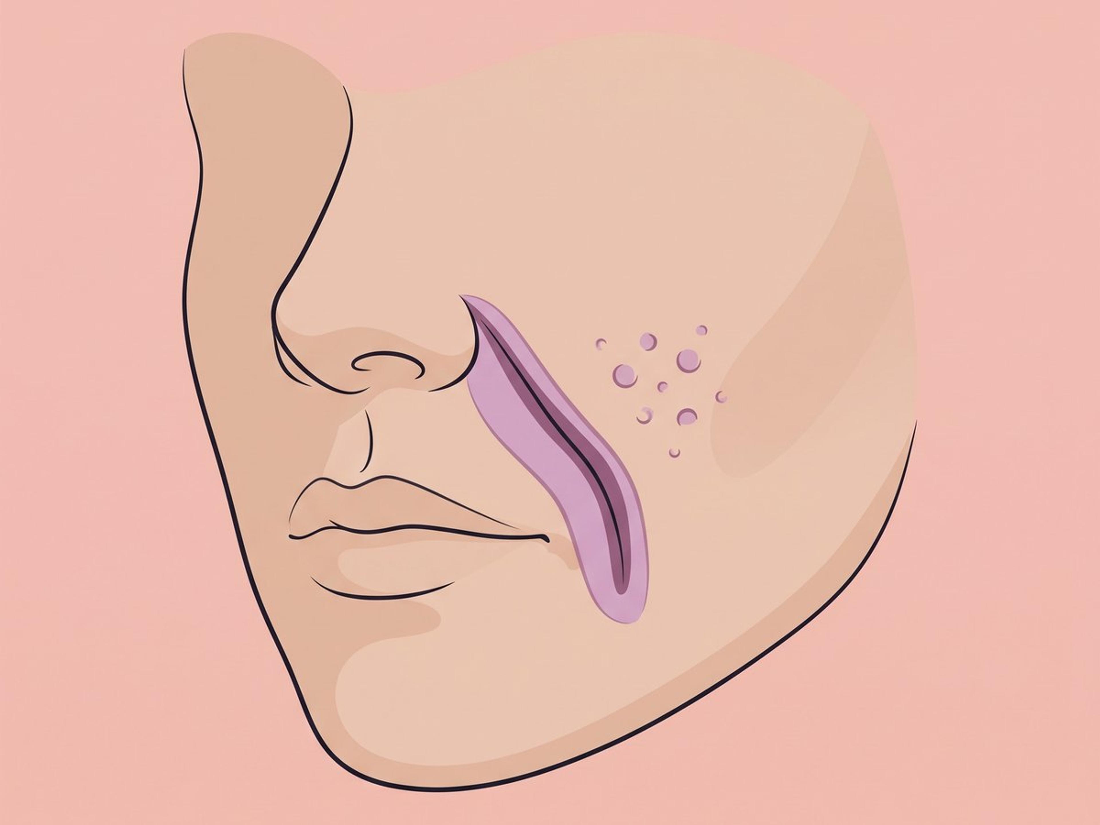 كريات PMMA-كولاجين المجهرية (PMMA) — illustration
