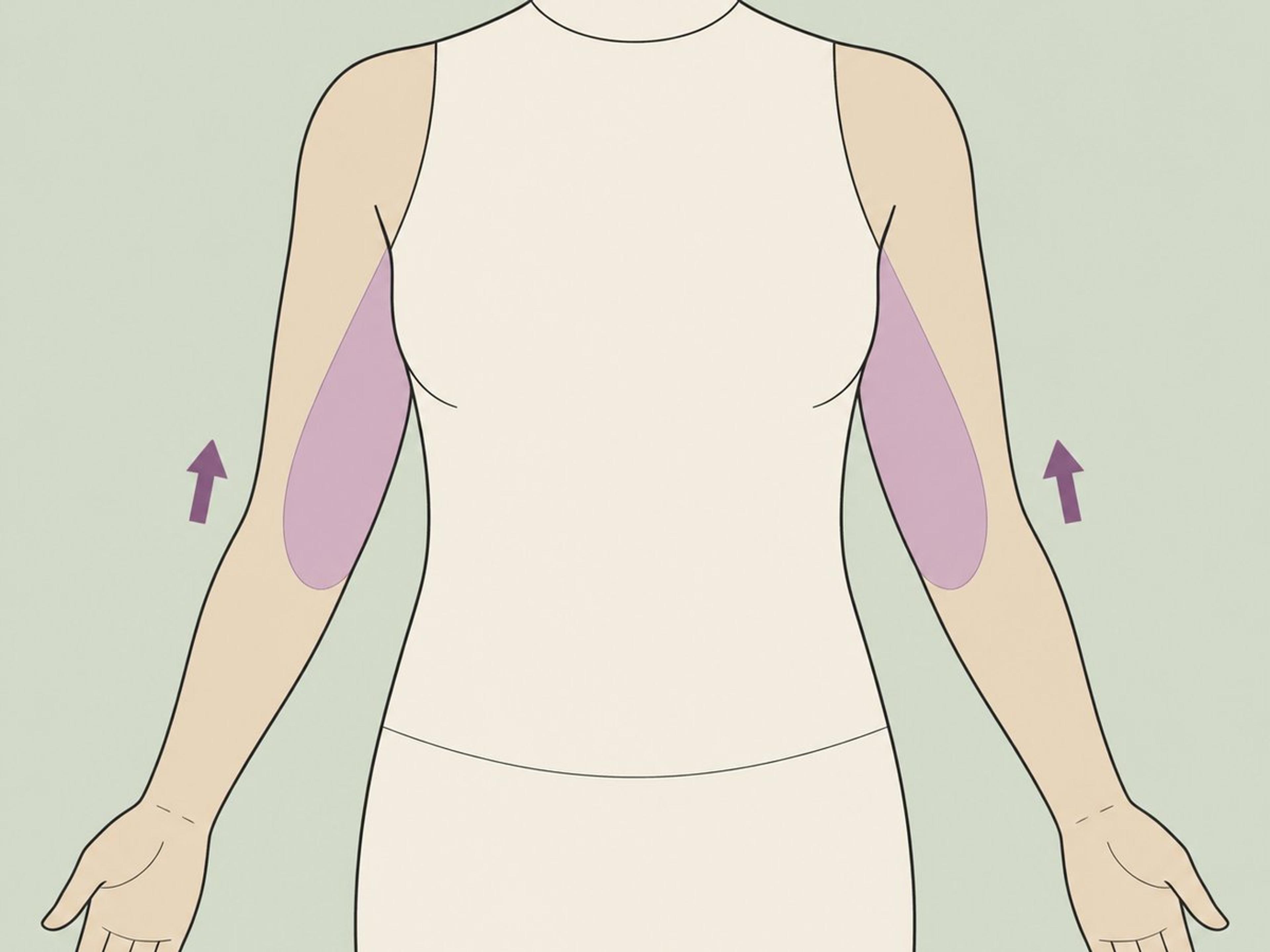 Oberarmstraffung (Brachioplastik) oder Oberschenkelstraffung — illustration