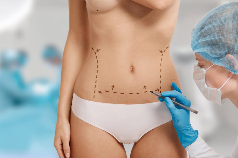 Abdominoplastie en Turquie : tarifs, forfaits et convalescence