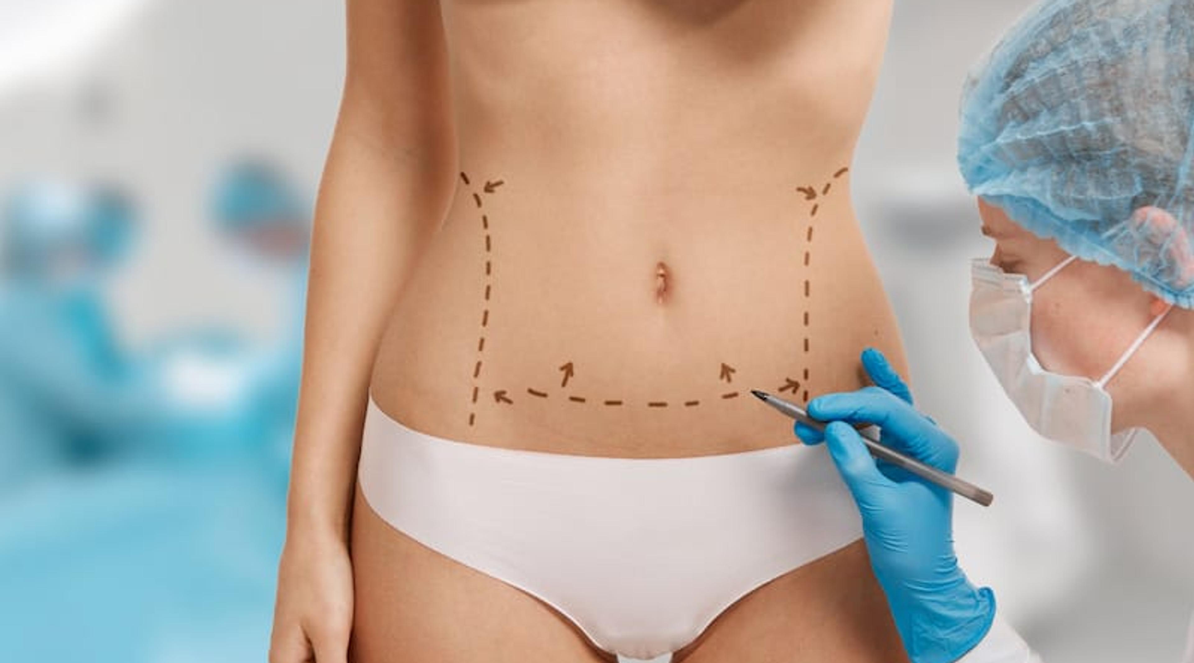 Abdominoplastie en Turquie : tarifs, forfaits et convalescence