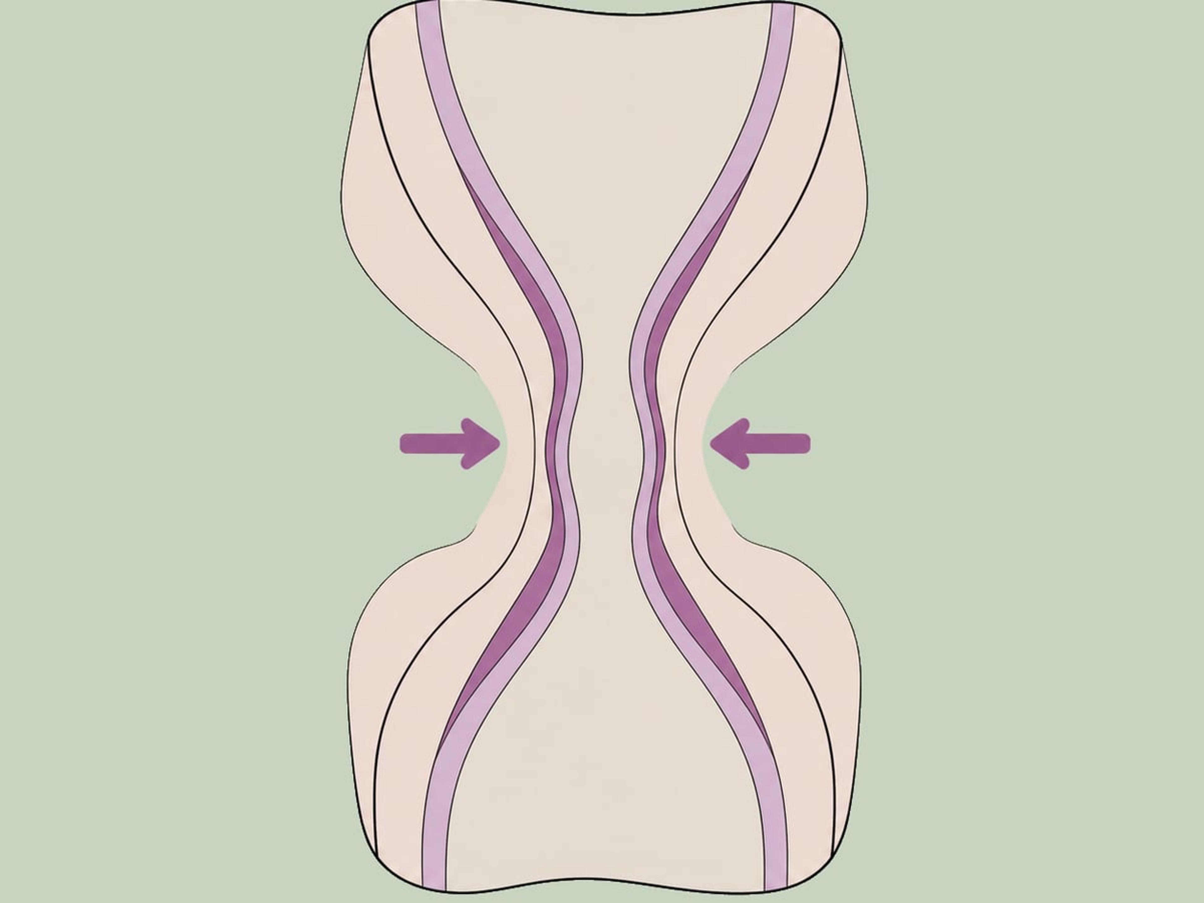 Vaginoplastik (Vaginalstraffung) — illustration