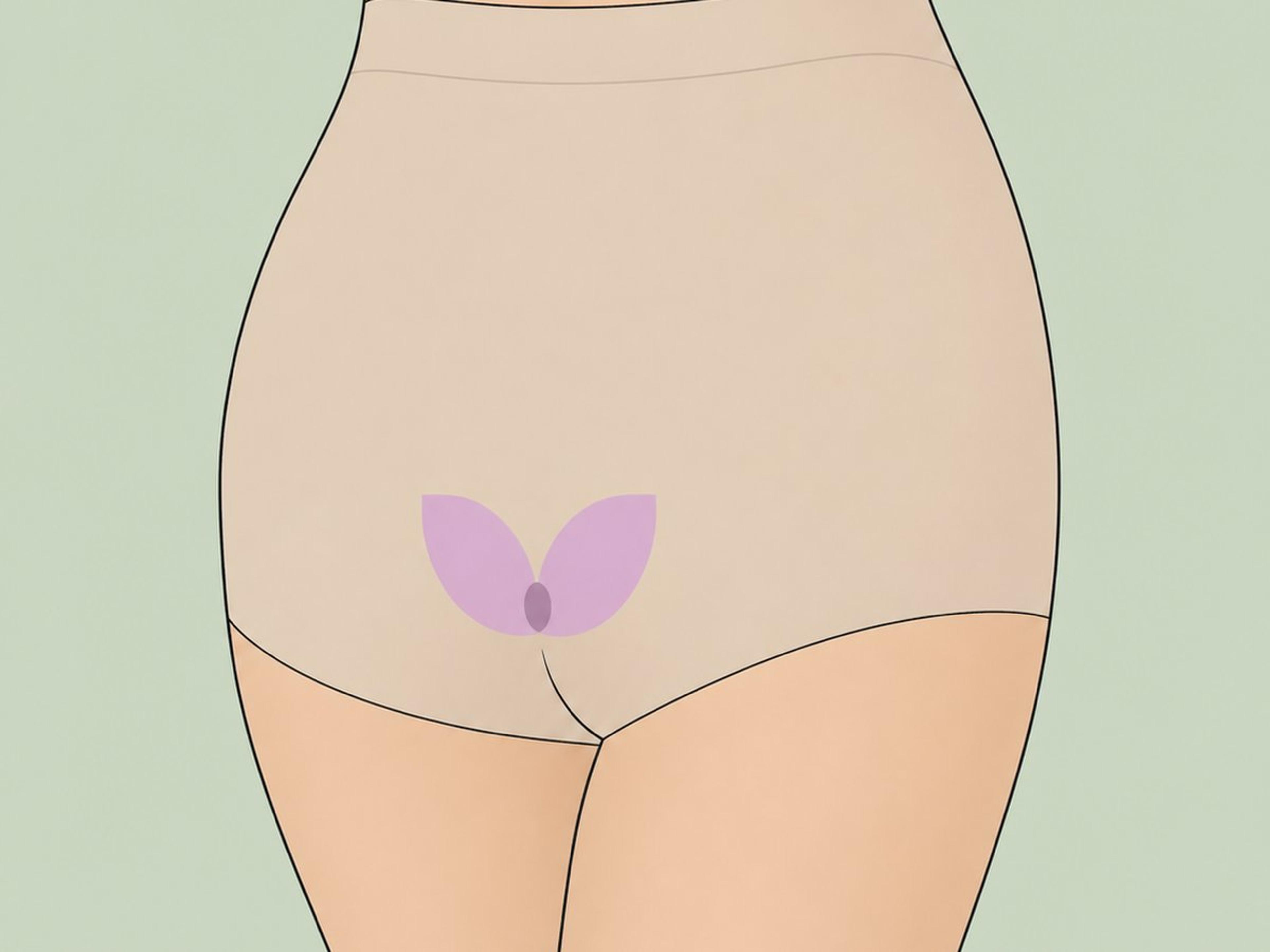 Vaginoplastik und Labioplastik — illustration