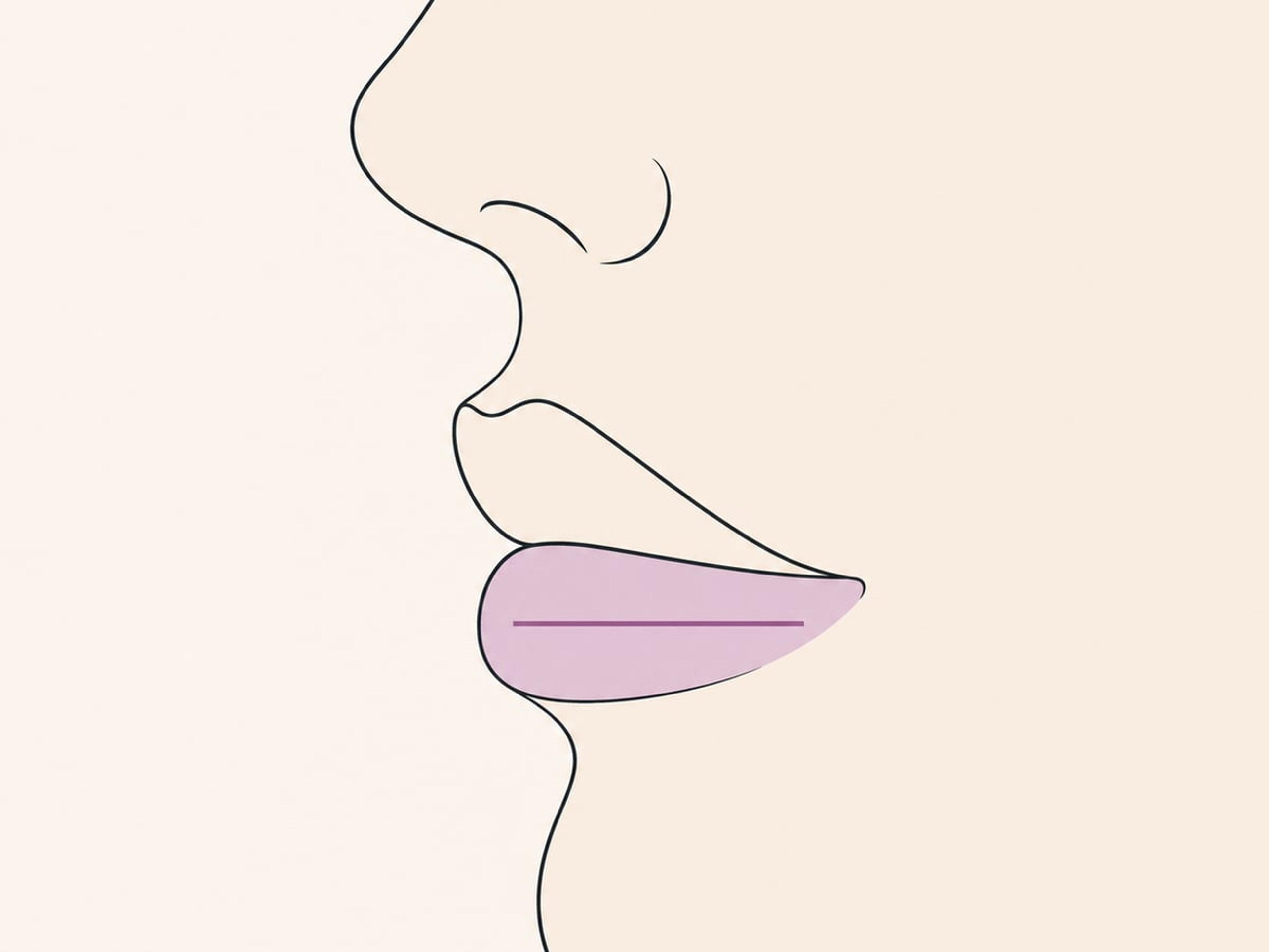 Técnica lineal — illustration