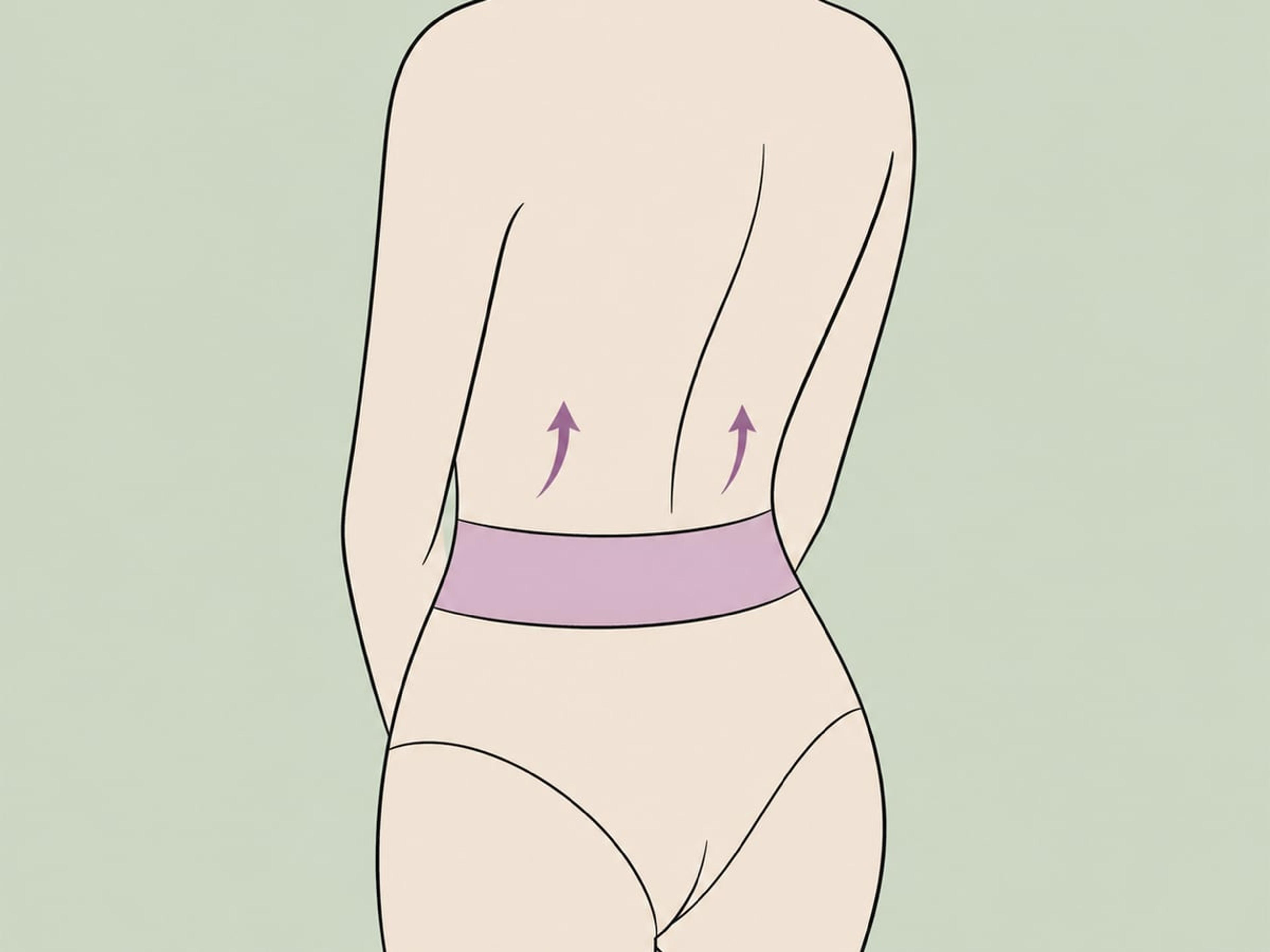 360-Grad-Bauchdeckenstraffung (zirkumferenzielles Bodylift) — illustration