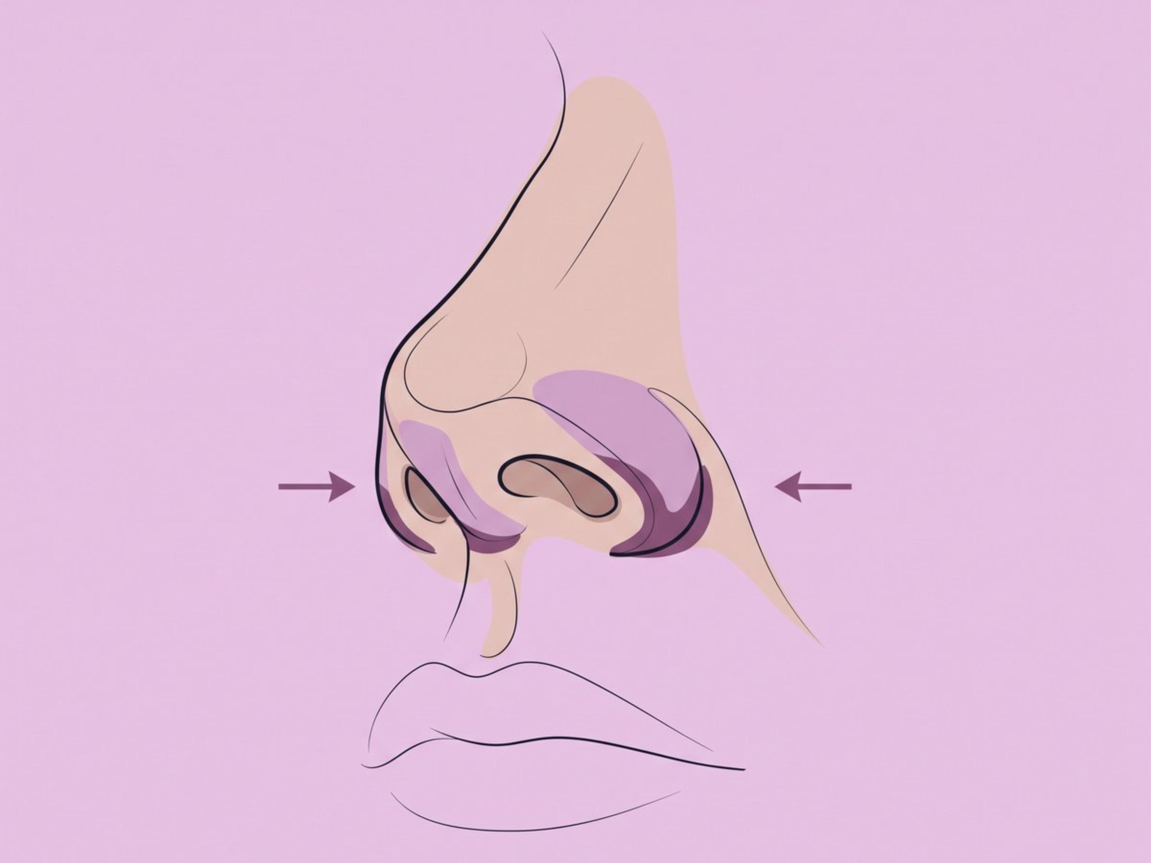 Verkleinerung der Nasenbasis — illustration