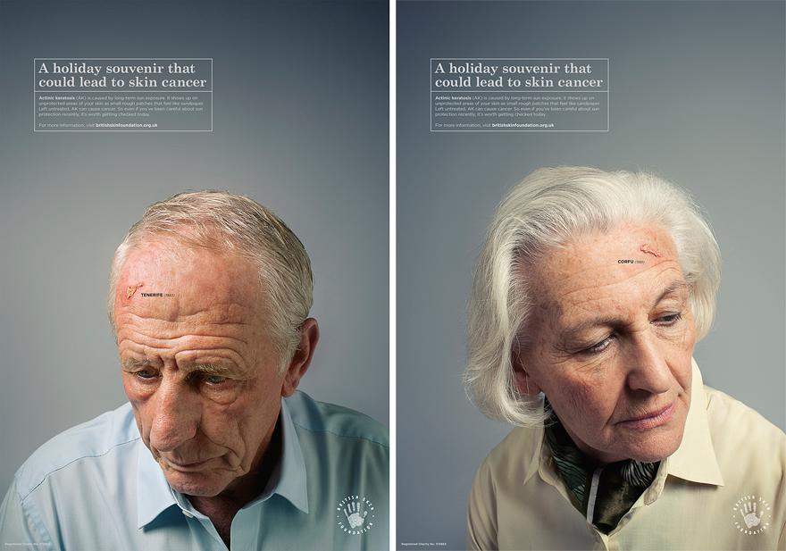 Two elderly men with skin cancer scars on their faces, wearing white shirts and looking directly at the camera.