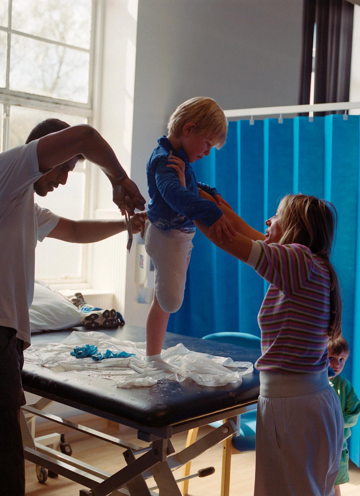A man and a woman are assisting a boy with a prosthetic leg to sit up on a bed.