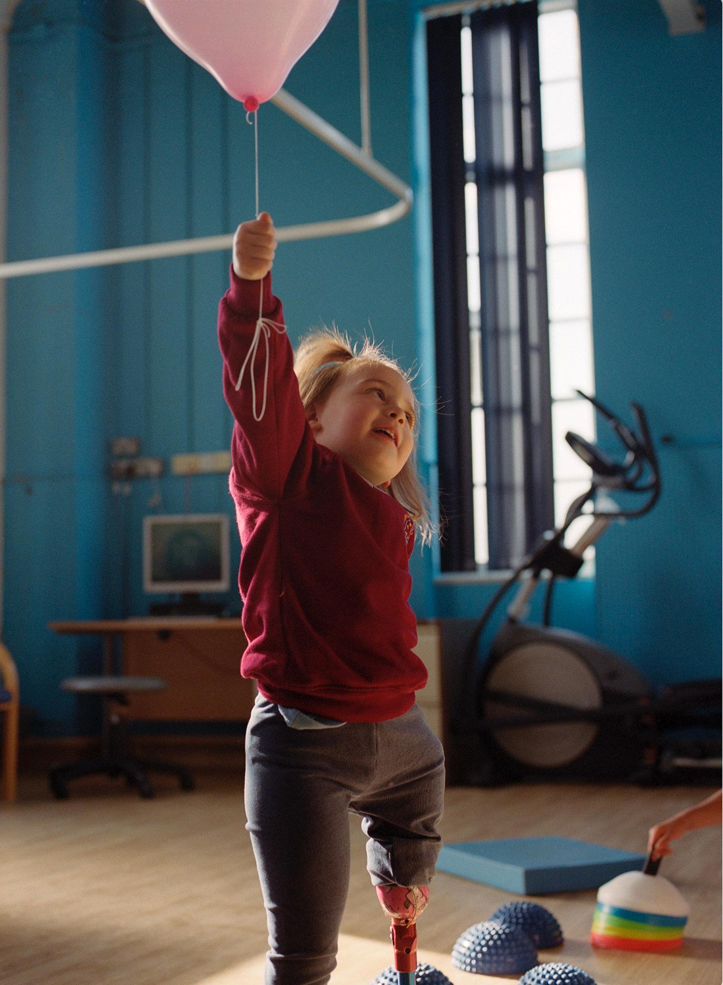 A young girl with a prosthetic leg is standing in a gym or studio, holding a pink balloon and smiling.