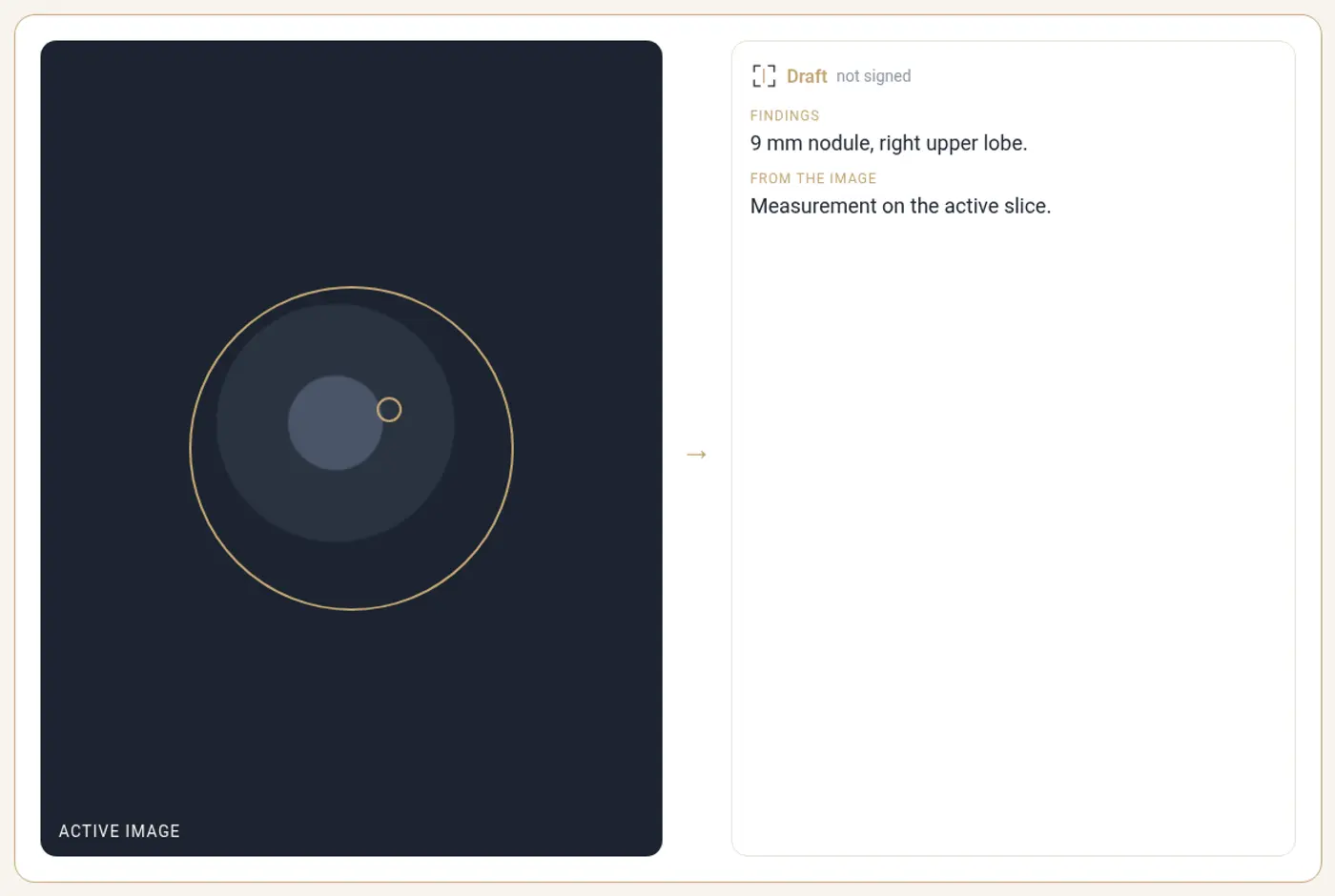 Active image going into the report