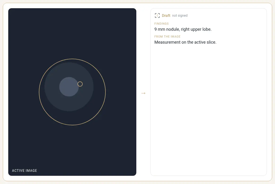 Active image going into the report