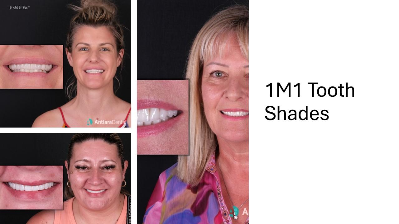 Three women smiling with close-ups of their white teeth