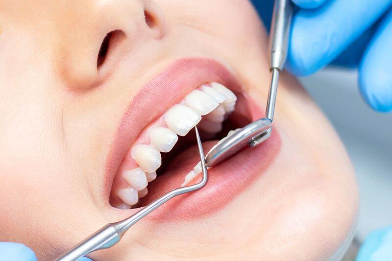 Close-up of teeth examined with a dental mirror and probe