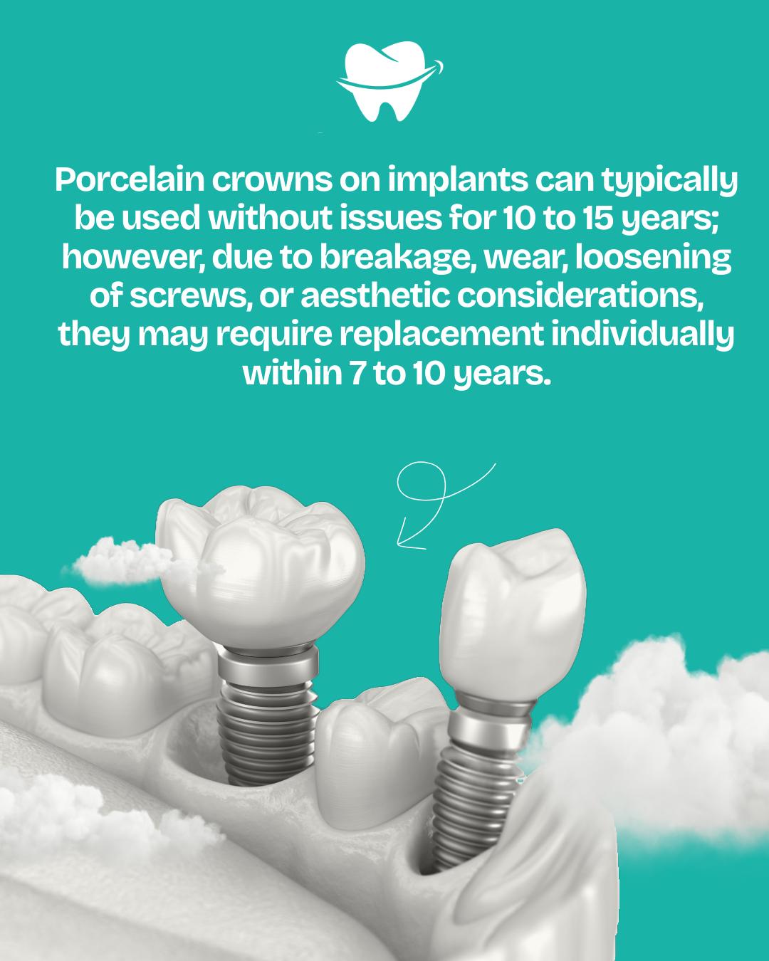 Two implant crowns on a jaw model with text about crown lifespan