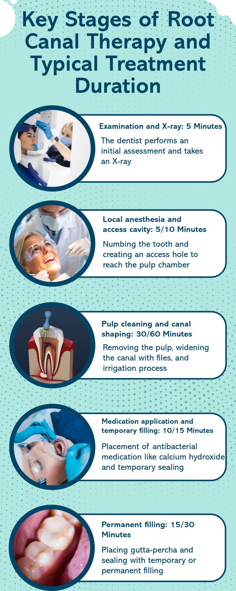 Infographic of root canal stages with minutes for each