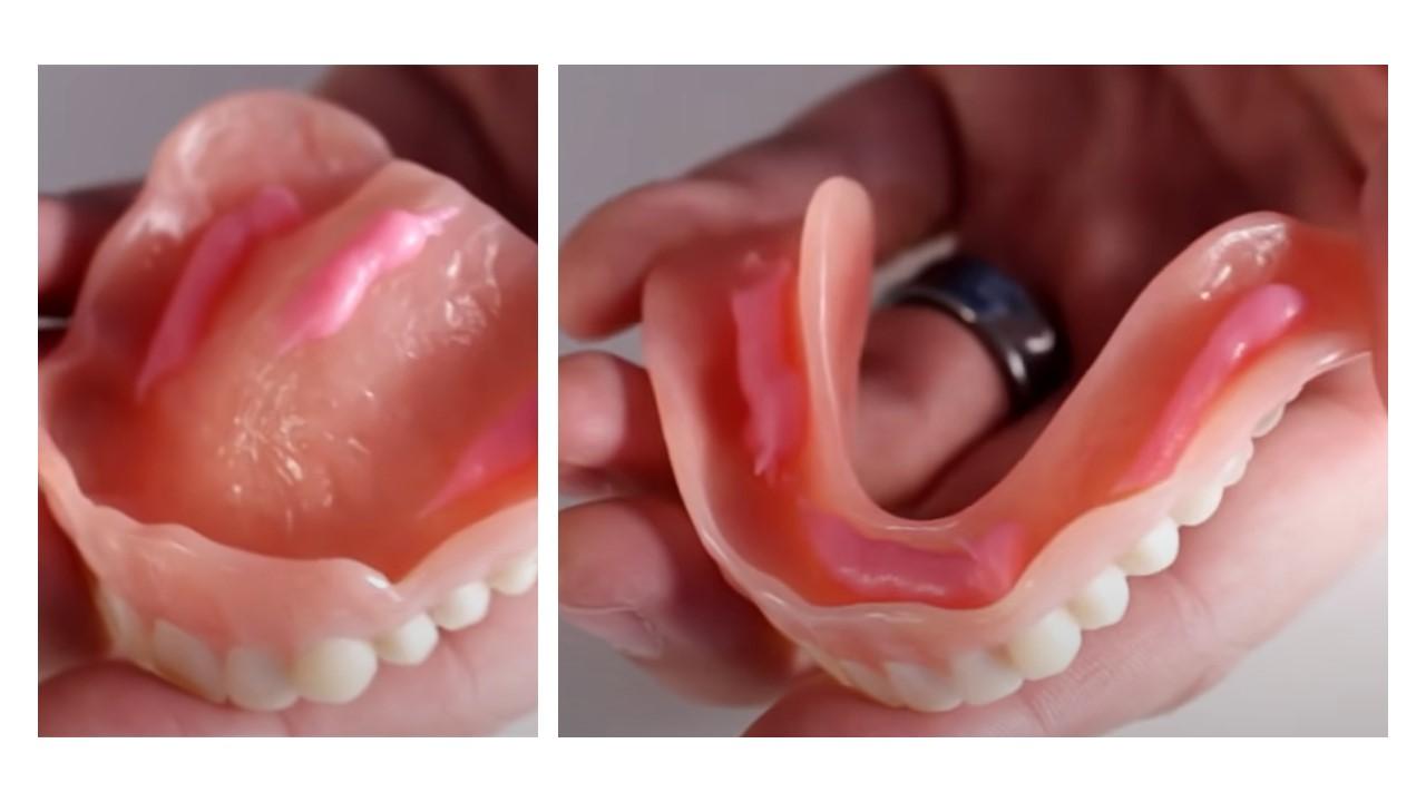 Denture with adhesive cream applied along the fitting surface