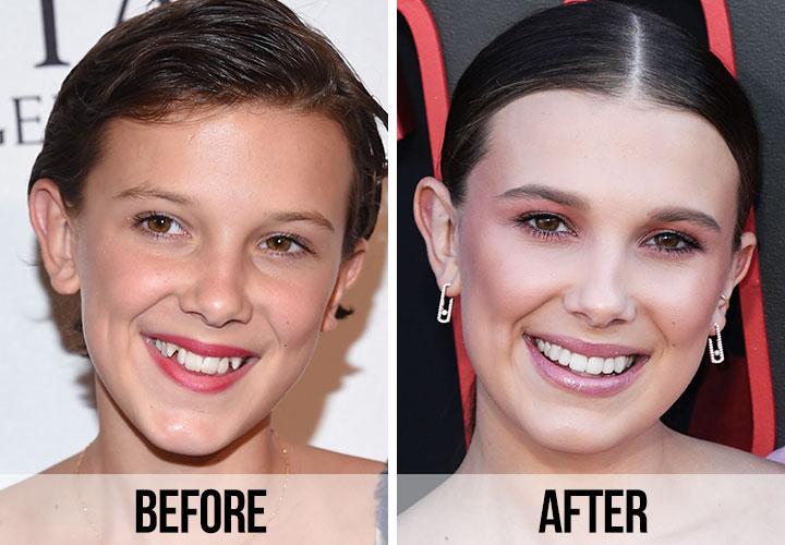 Millie-Bobby-Brown