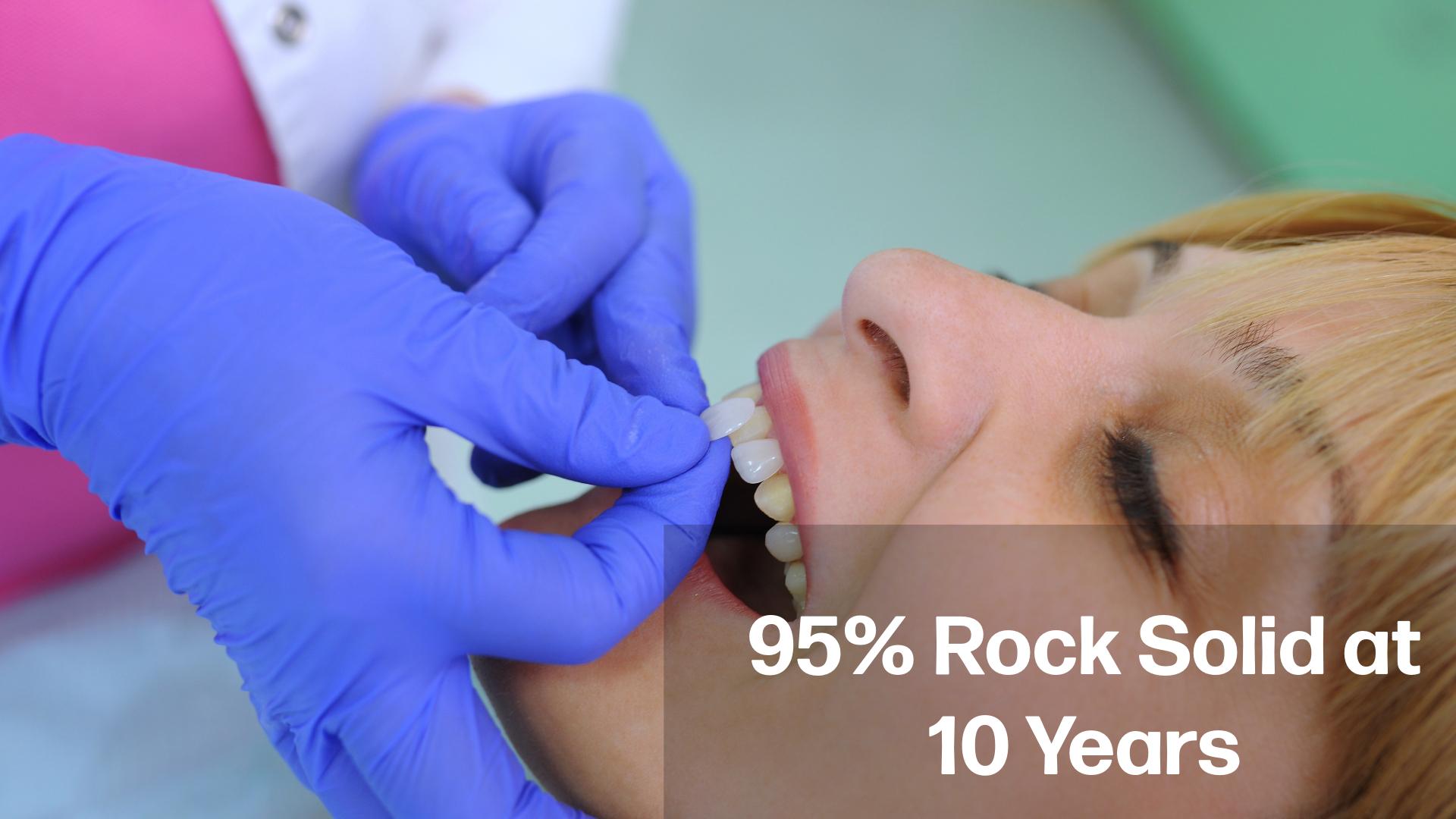 Dentist holding a veneer against a patient's front teeth