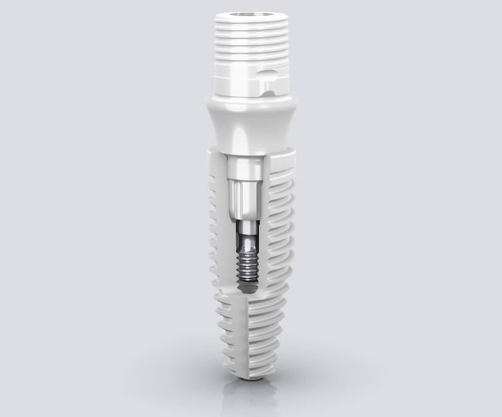 Cutaway view of a white ceramic dental implant showing its internal screw