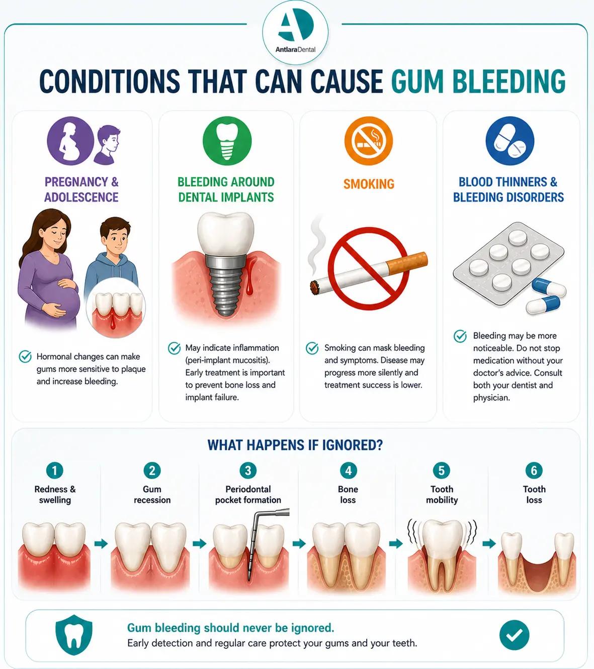 Illustrated infographic of conditions that can cause gum bleeding
