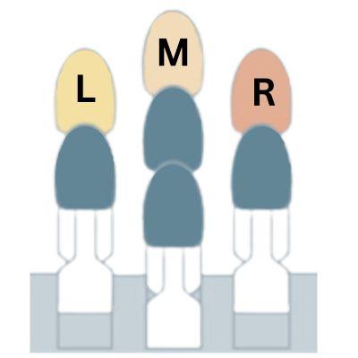 Diagram of three tooth shade samples labelled L, M and R