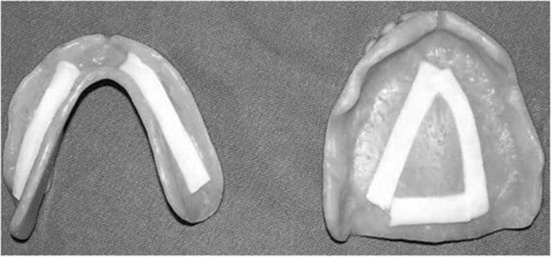 Two dentures with adhesive strips on the fitting surface