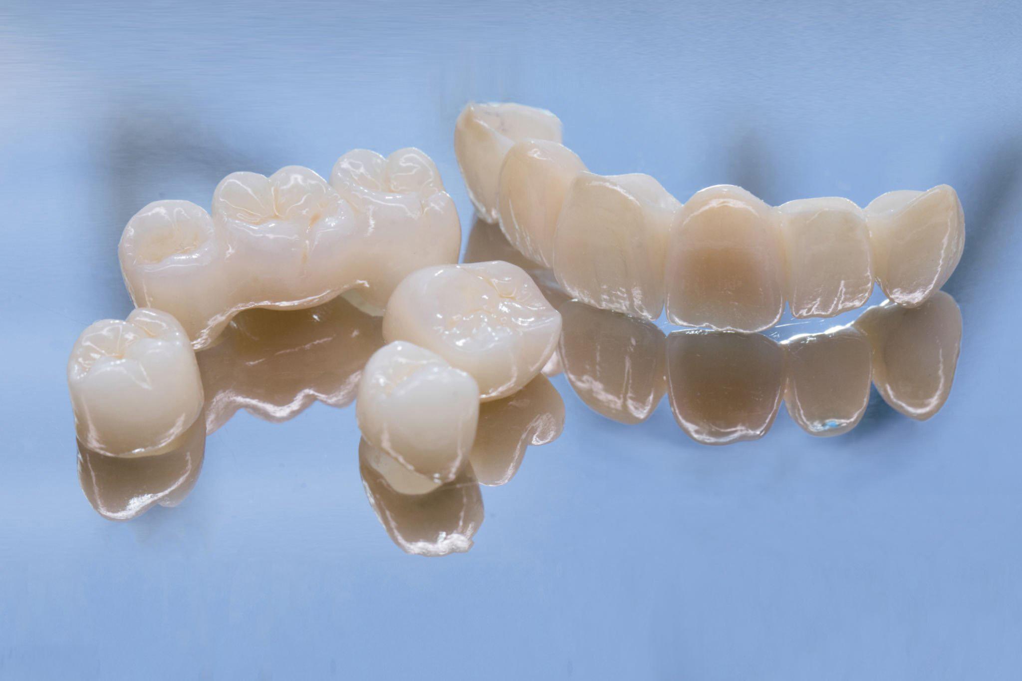 Laboratory-made tooth-coloured crowns and a bridge on a glass surface