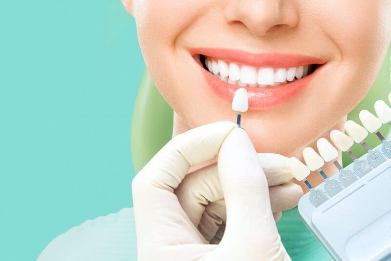 Gloved hand holding a tooth shade guide next to a smile