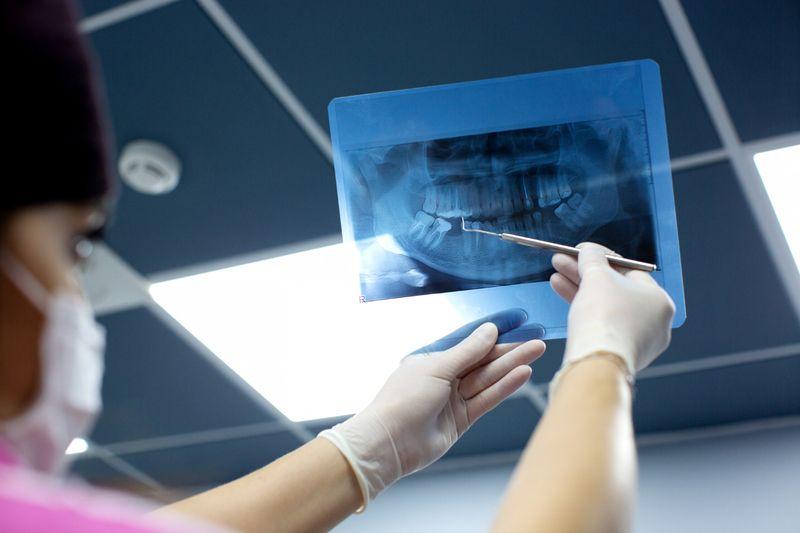 Clinician pointing at a panoramic dental X-ray